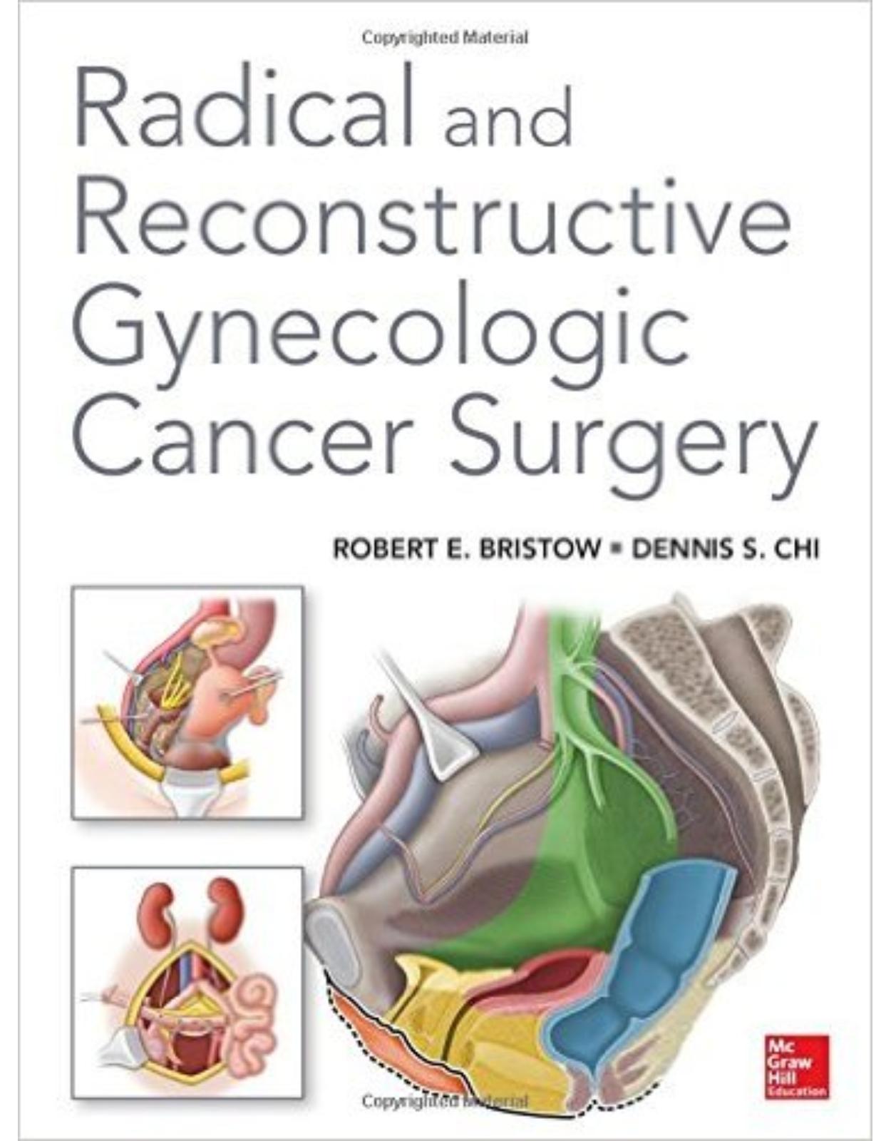 Radical and Reconstructive Gynecologic Cancer Surgery 1st Edition