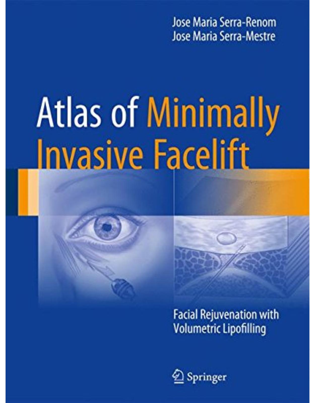 Atlas of Minimally Invasive Facelift: Facial Rejuvenation with Volumetric Lipofilling