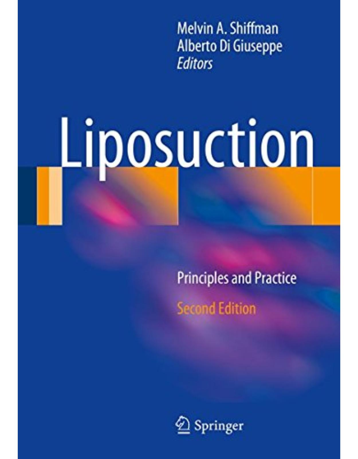 Liposuction: Principles and Practice