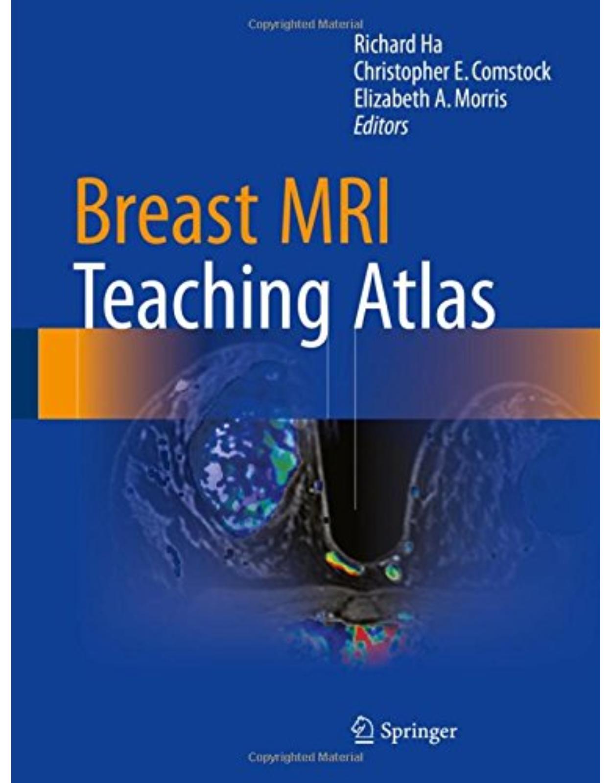 Breast MRI Teaching Atlas