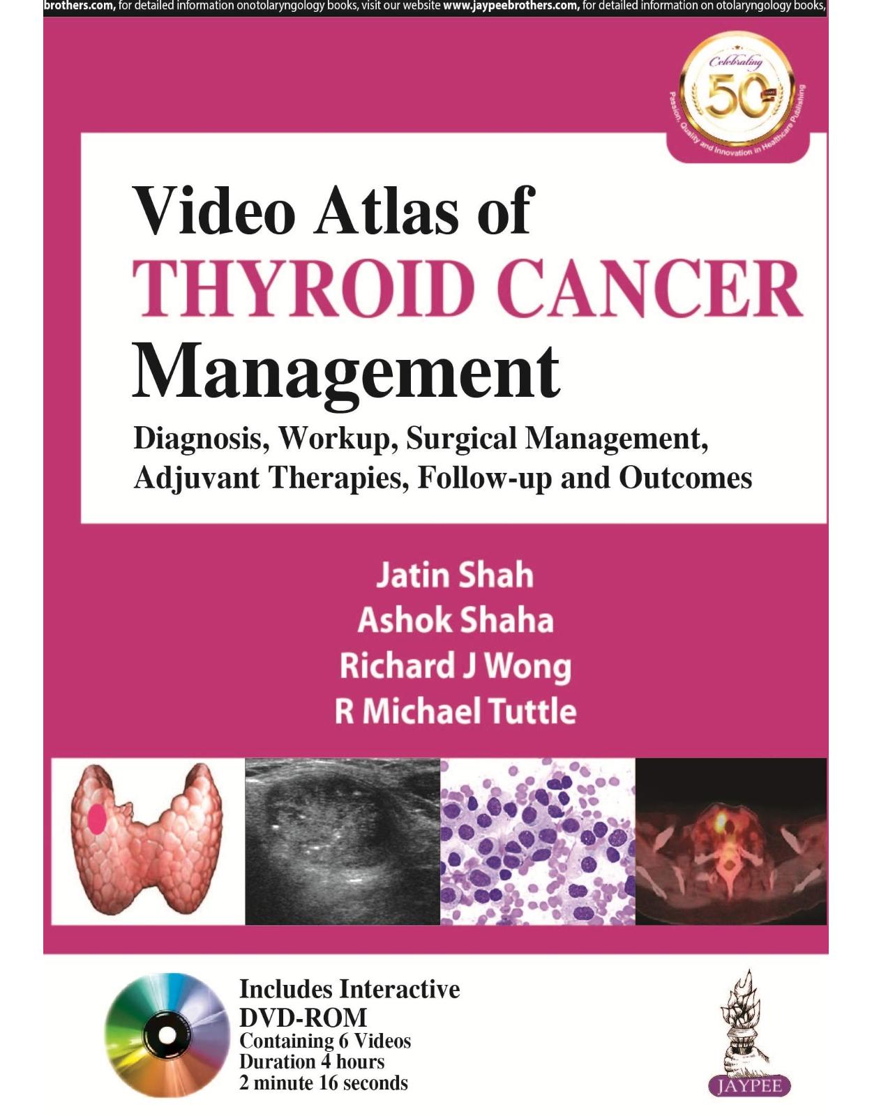 Video Atlas of Thyroid Cancer Management