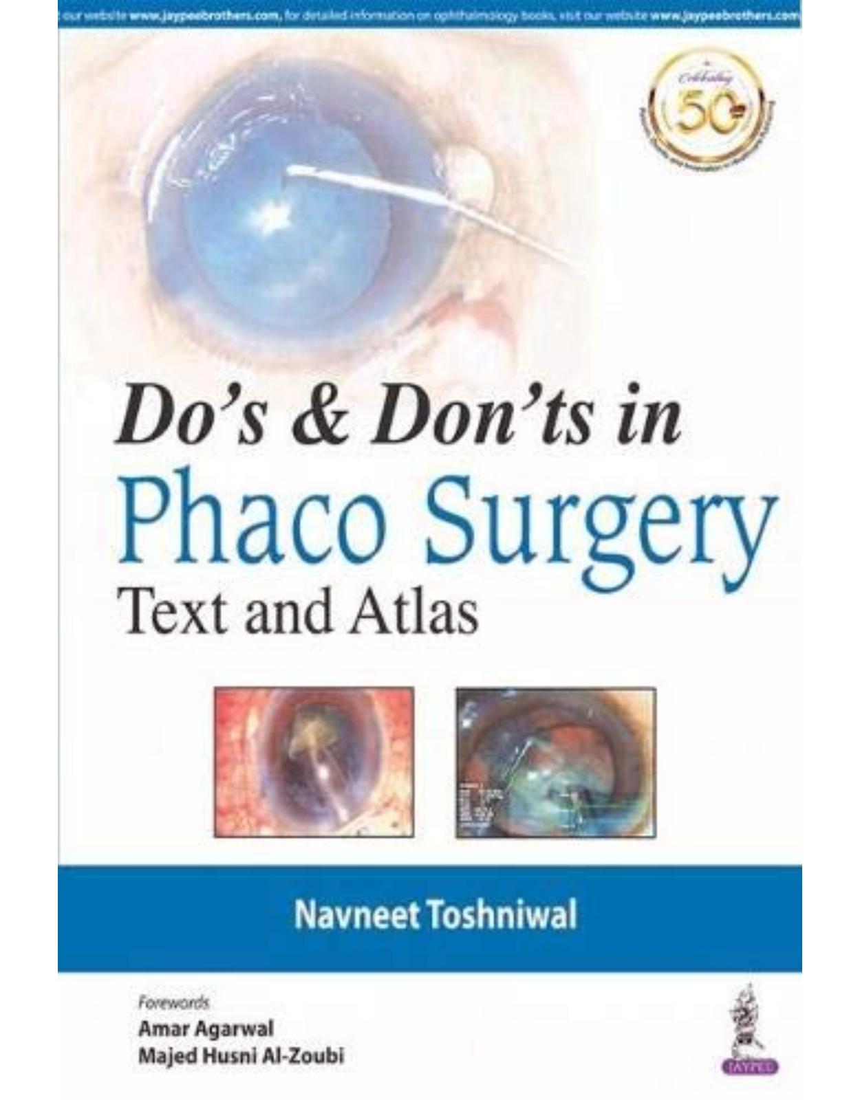 Do’s & Dont’s in Phaco Surgery