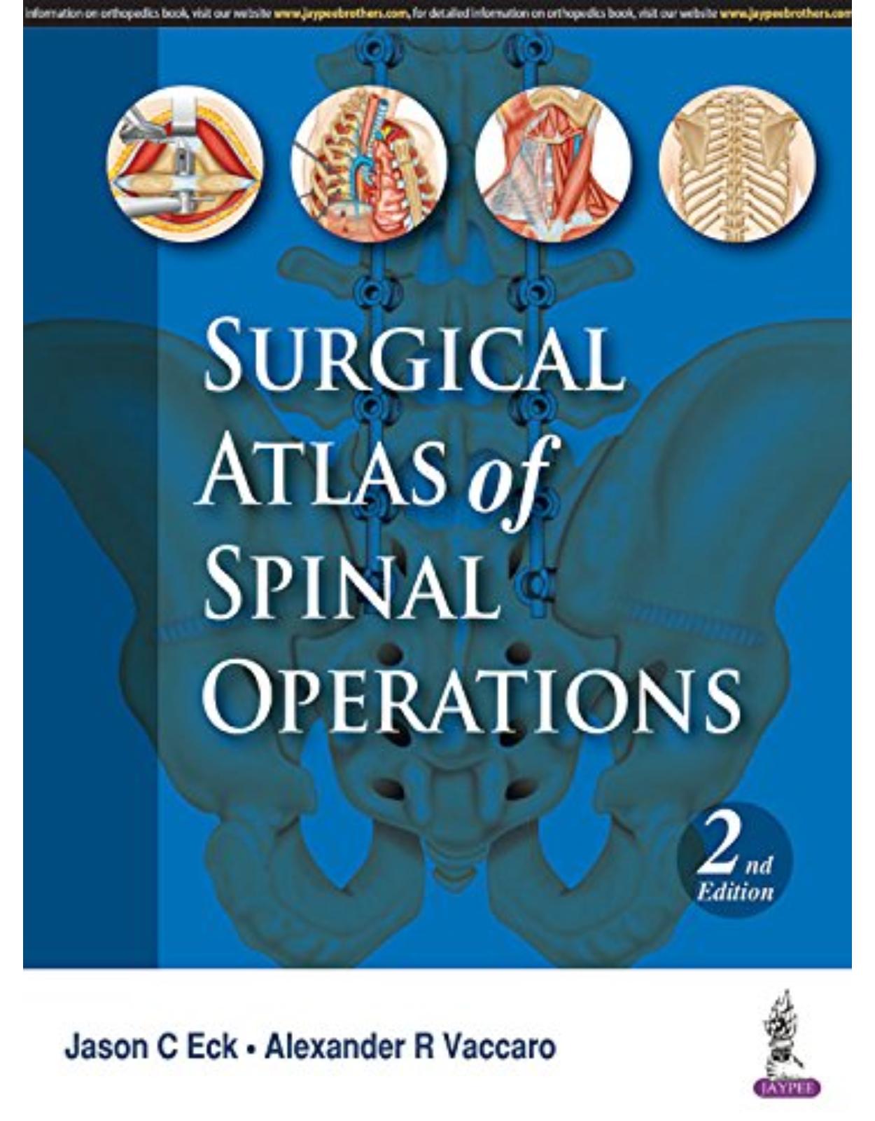 Surgical Atlas of Spinal Operations
