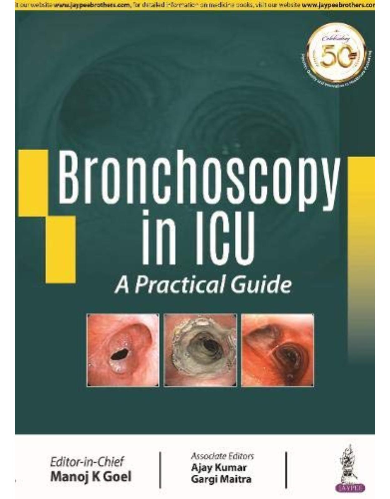 Bronchoscopy in ICU: A Practical Guide