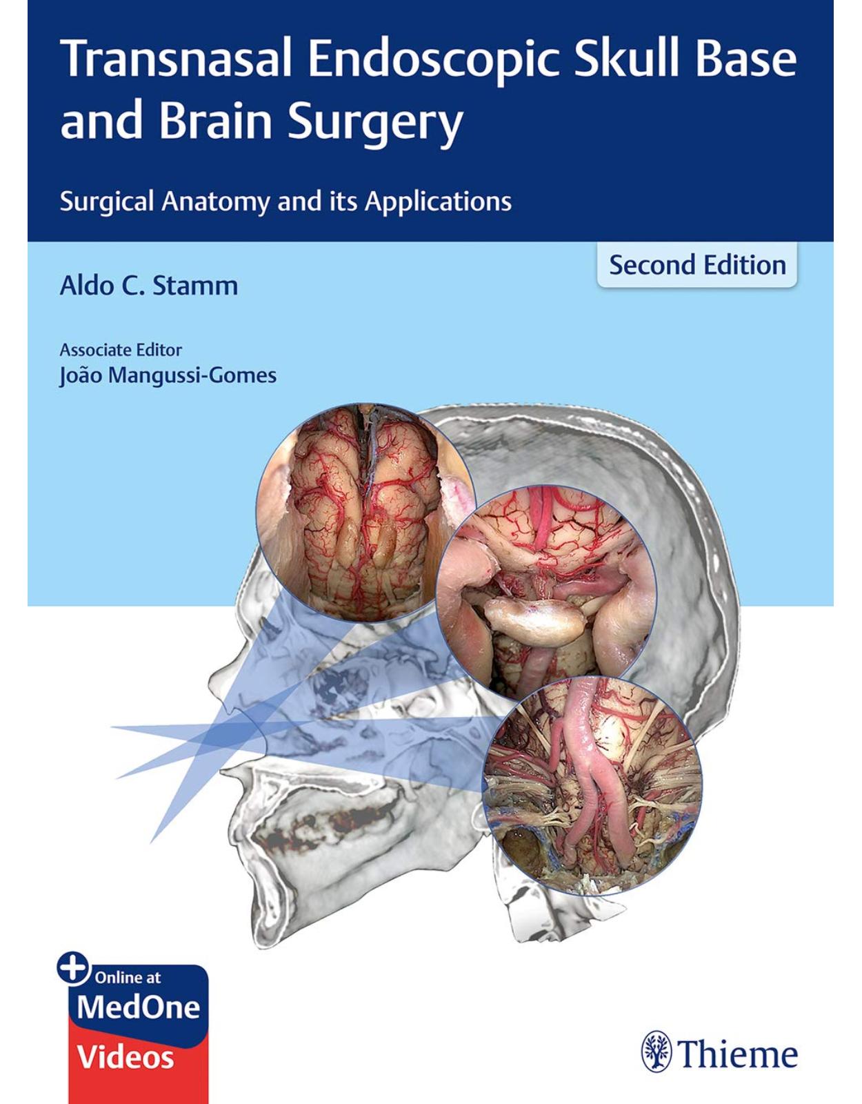 Transnasal Endoscopic Skull Base and Brain Surgery: Surgical Anatomy and its Applications