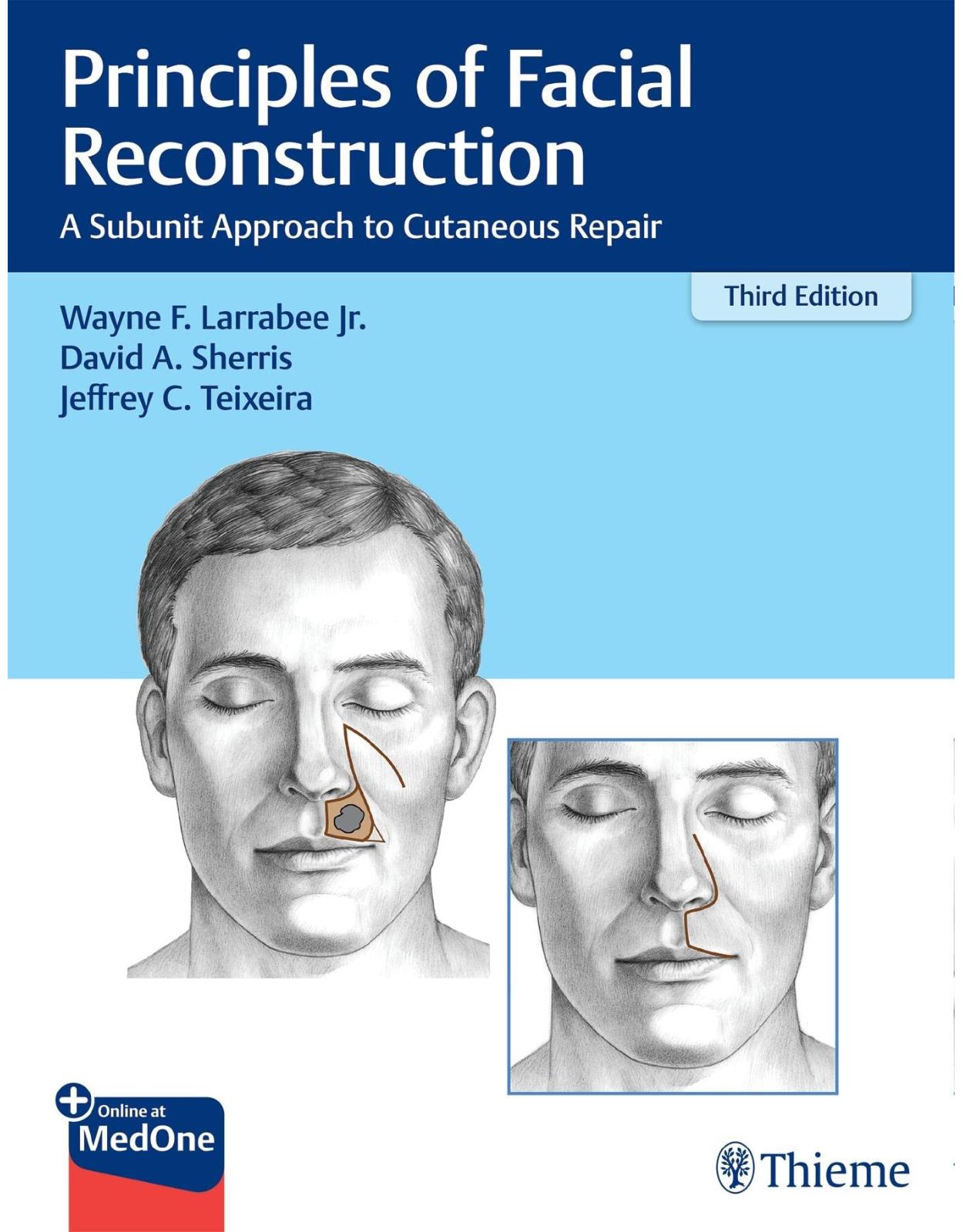 Principles of Facial Reconstruction