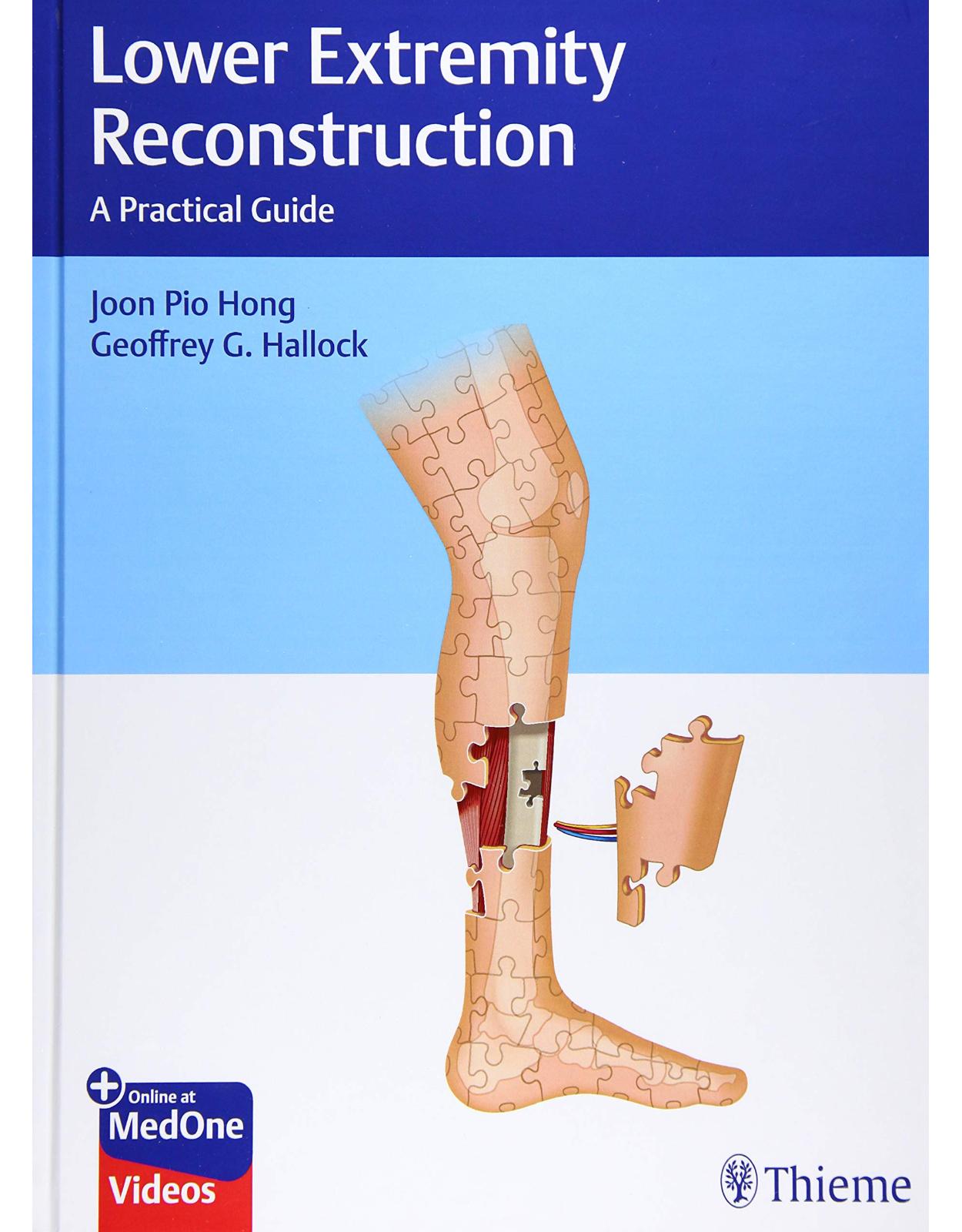 Lower Extremity Reconstruction: A Practical Guide