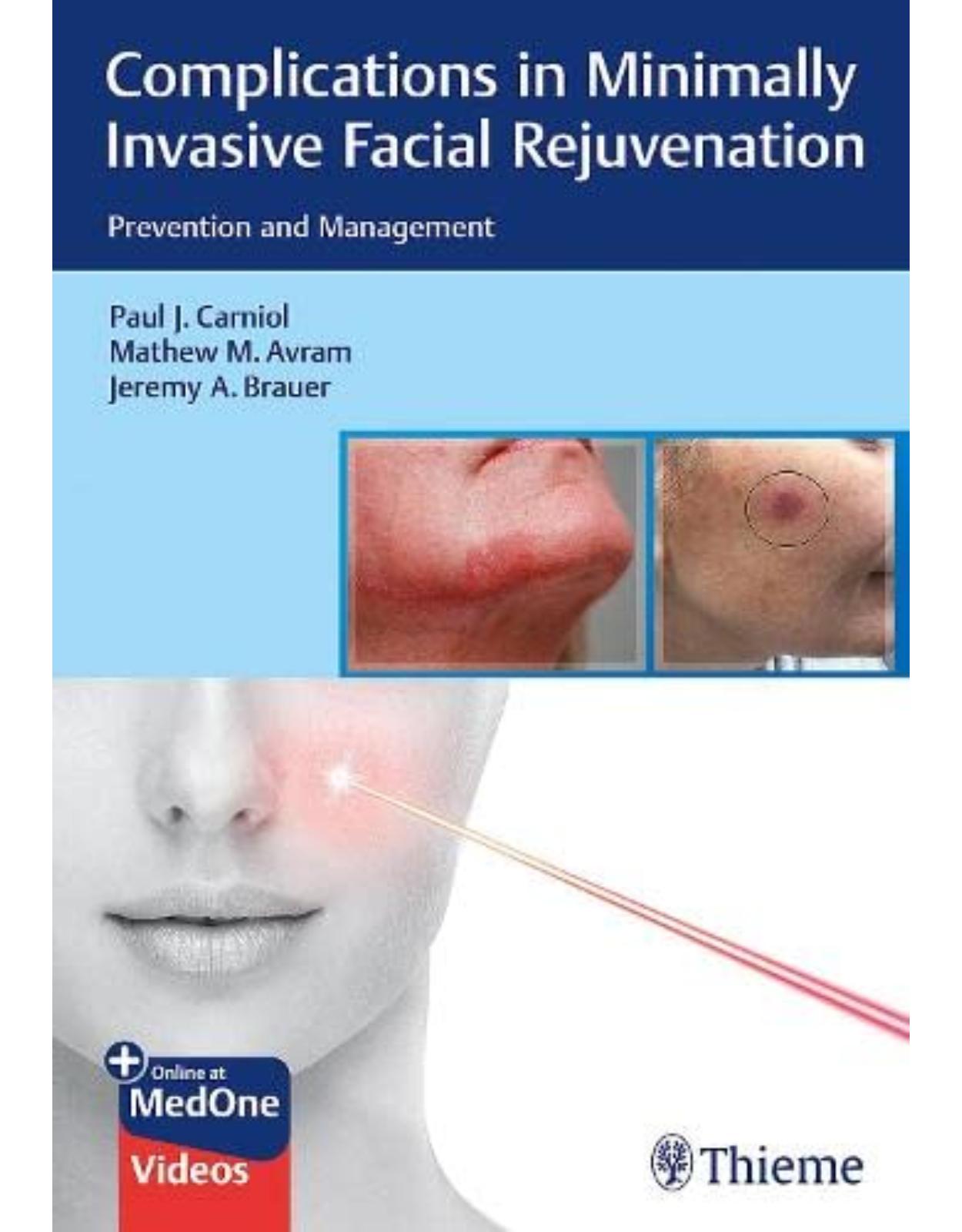 Complications in Minimally Invasive Facial Rejuvenation