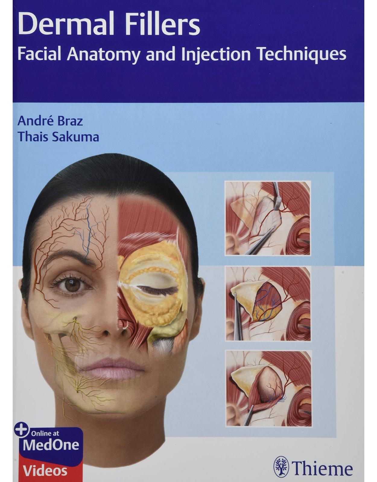 Dermal Fillers: Facial Anatomy and Injection Techniques