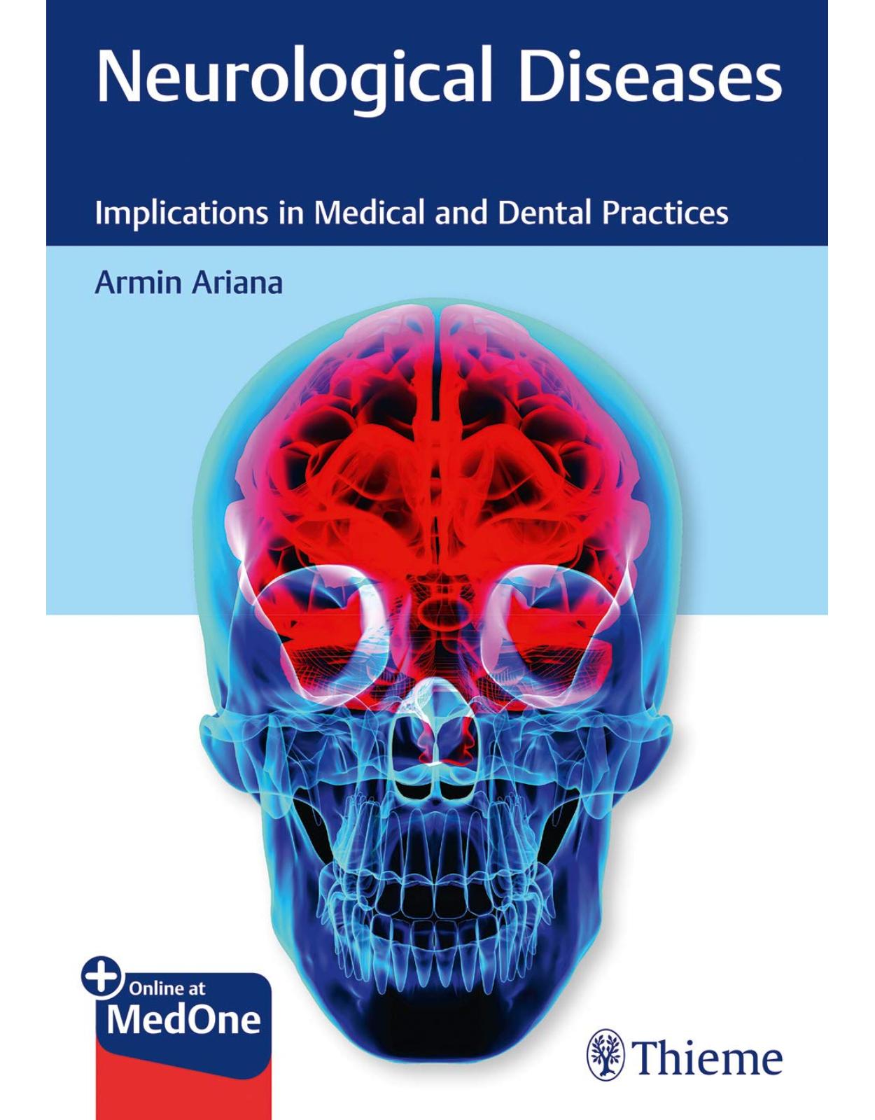 Neurological Diseases Implications in Medical and Dental Practices