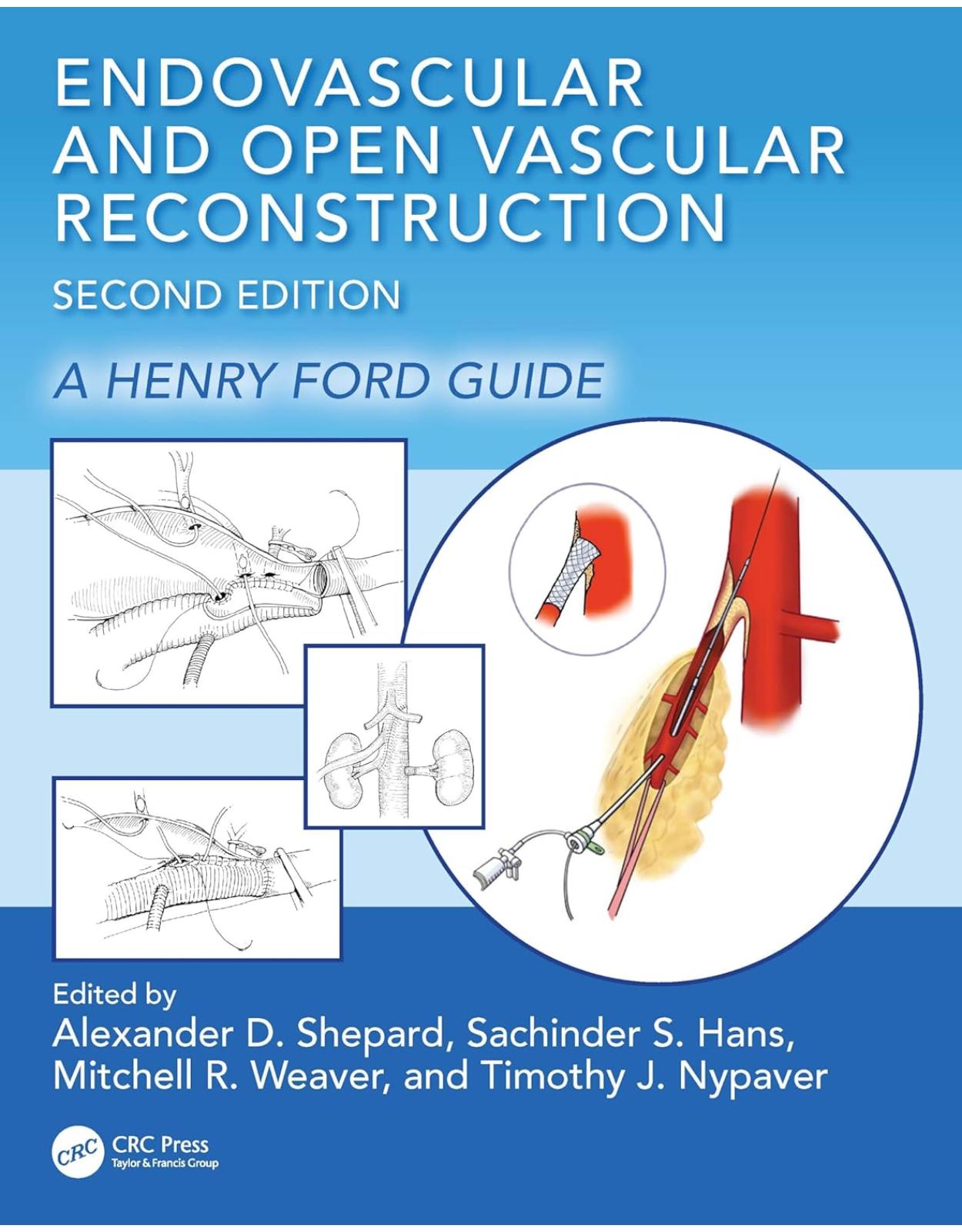 Endovascular and Open Vascular Reconstruction: A Henry Ford Surgical Guide 2nd Edition