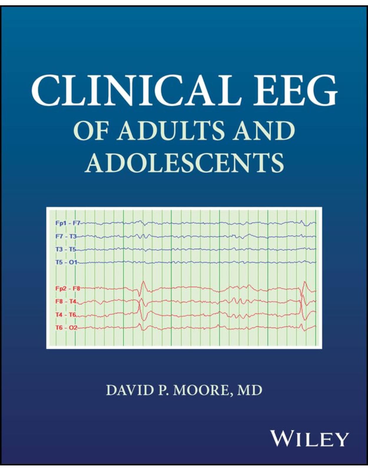 Clinical EEG of Adults and Adolescents 1st Edition