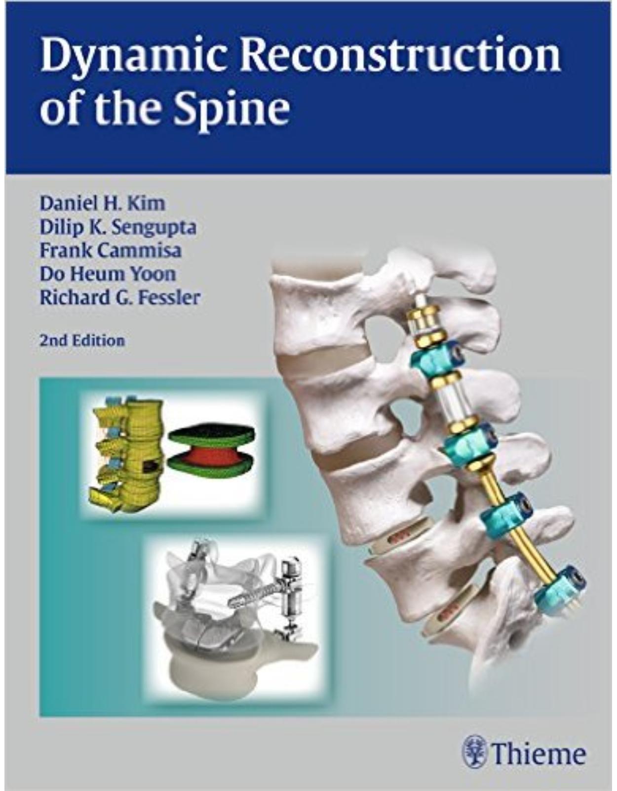 Dynamic Reconstruction of the Spine 2nd Edition