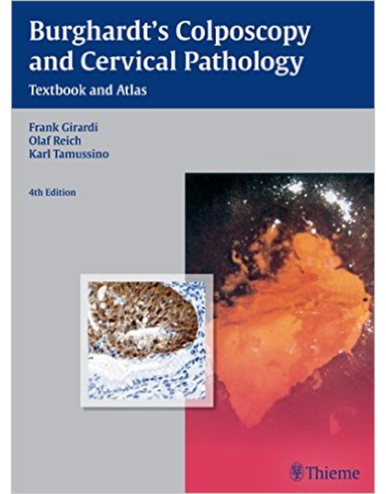 Burghardt's Colposcopy and Cervical Pathology: Textbook and Atlas 4th edition 