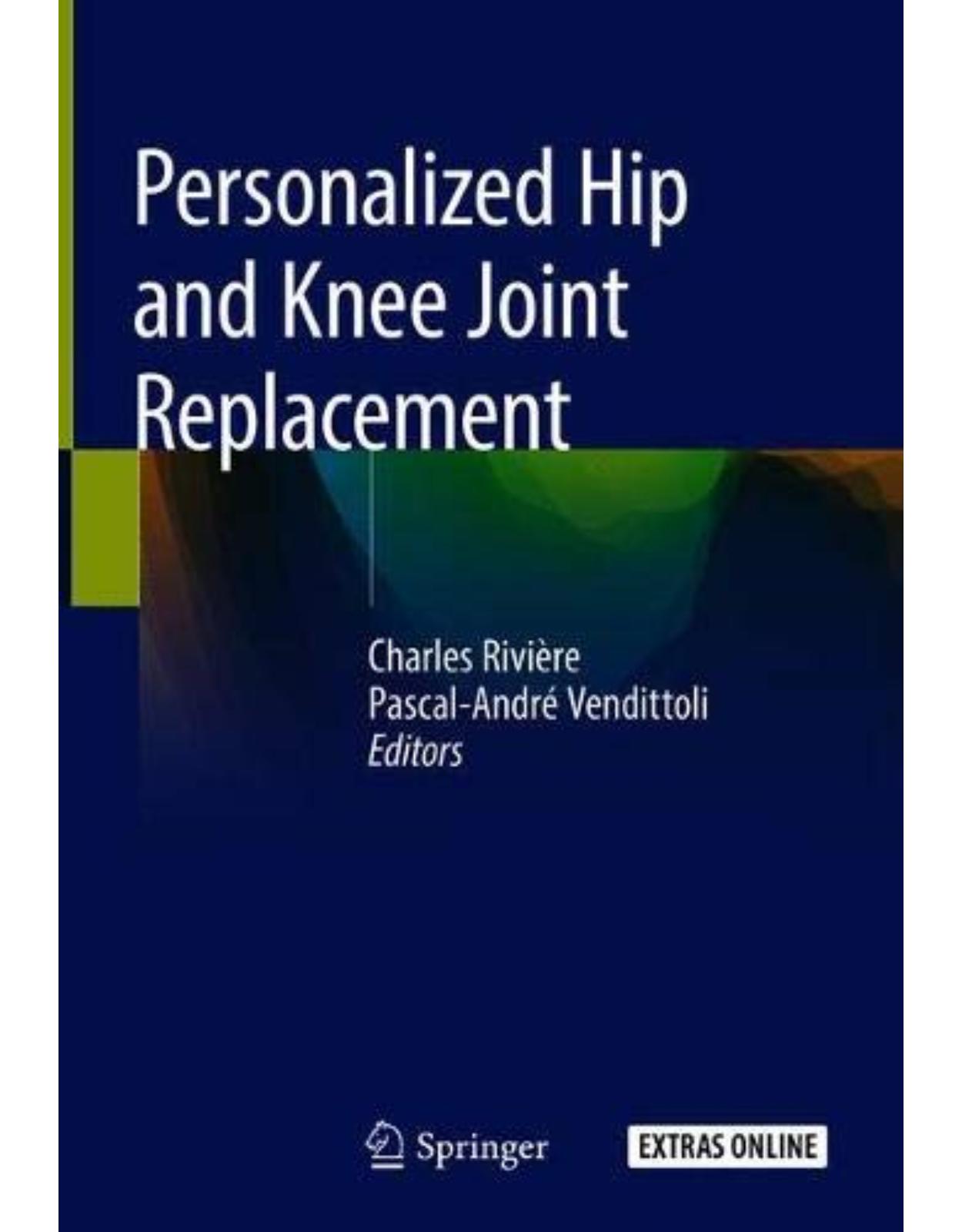 Personalized Hip and Knee Joint Replacement