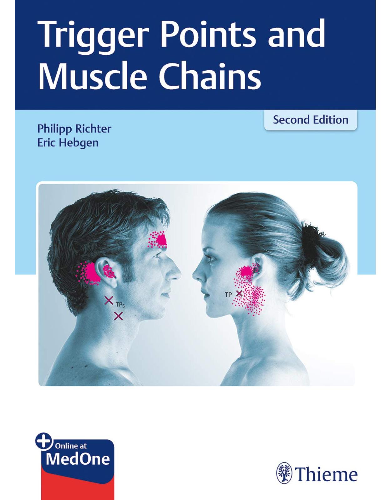 Trigger Points and Muscle Chains