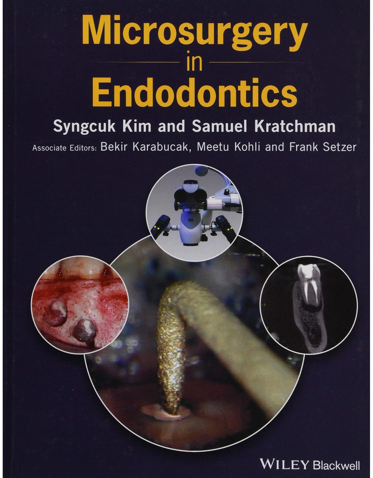 Microsurgery in Endodontics