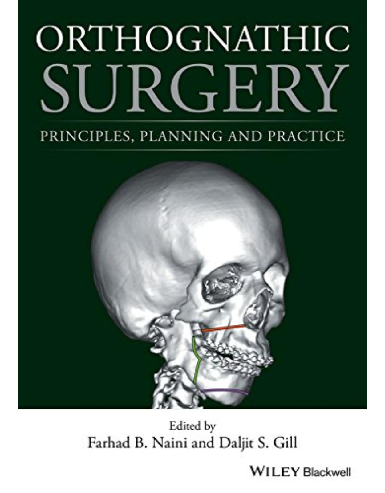 Orthognathic Surgery: Principles, Planning and Practice