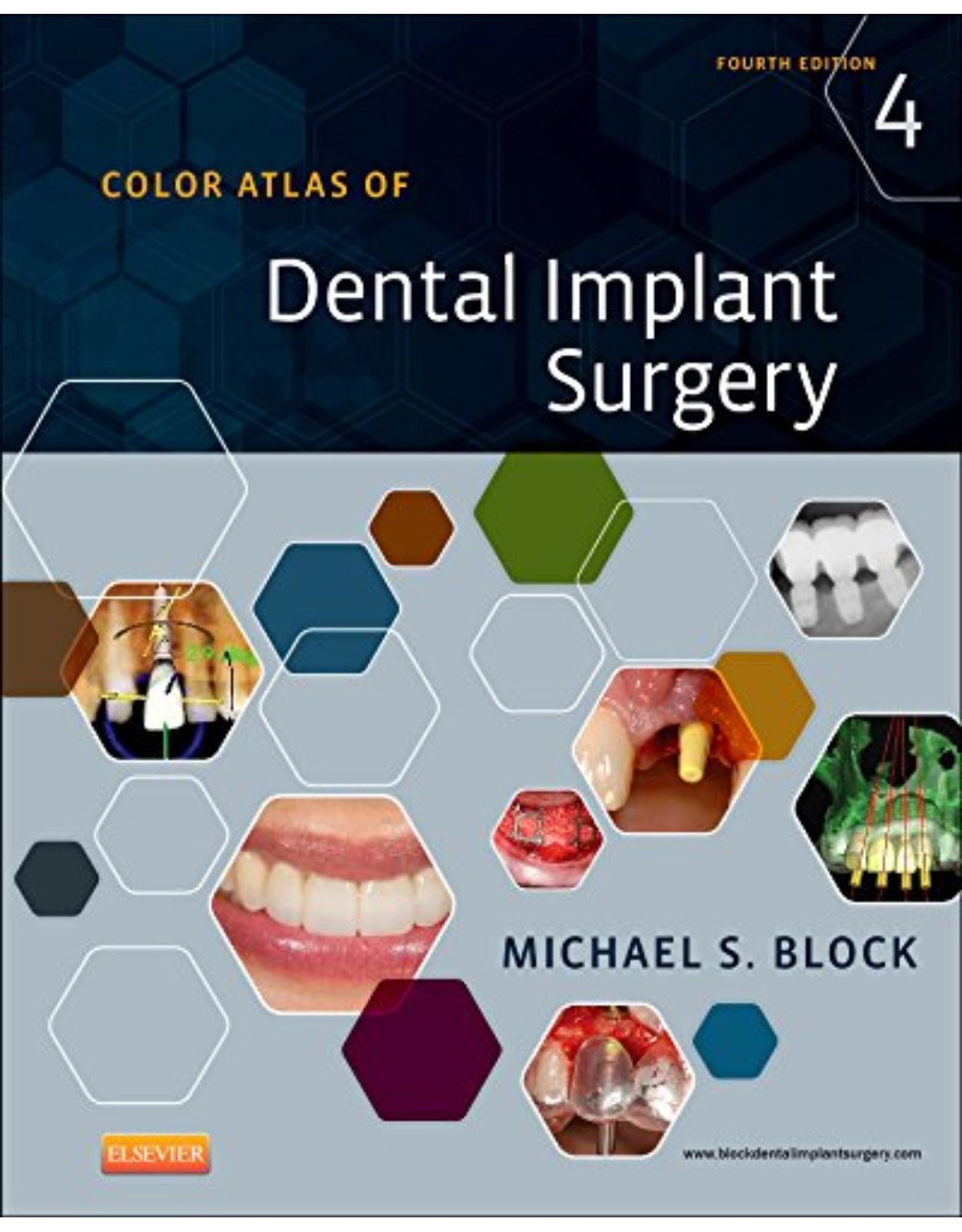 Color Atlas of Dental Implant Surgery, 4e