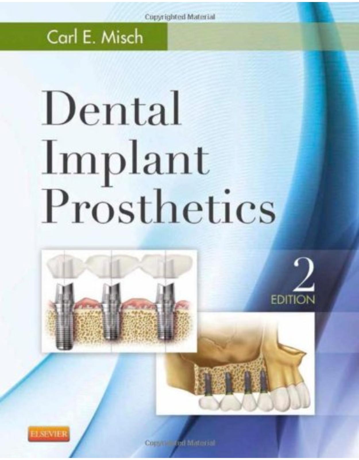 Dental Implant Prosthetics, 2nd Edition