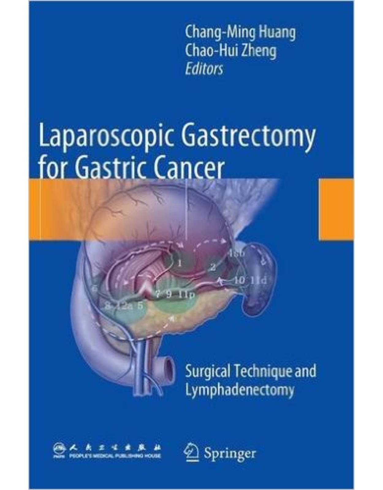 Laparoscopic Gastrectomy for Gastric Cancer: Surgical Technique and Lymphadenectomy 2015th Edition