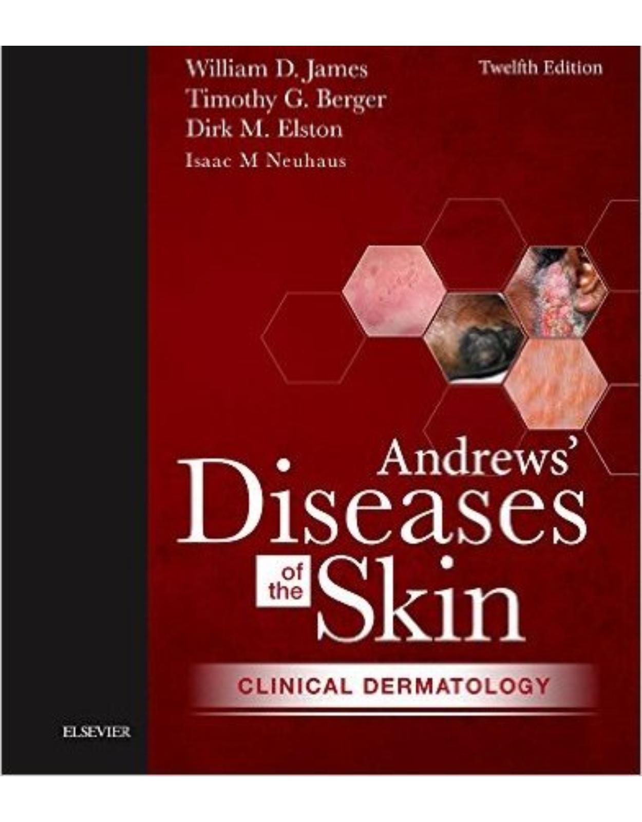 Andrews' Diseases of the Skin: Clinical Dermatology, 12e
