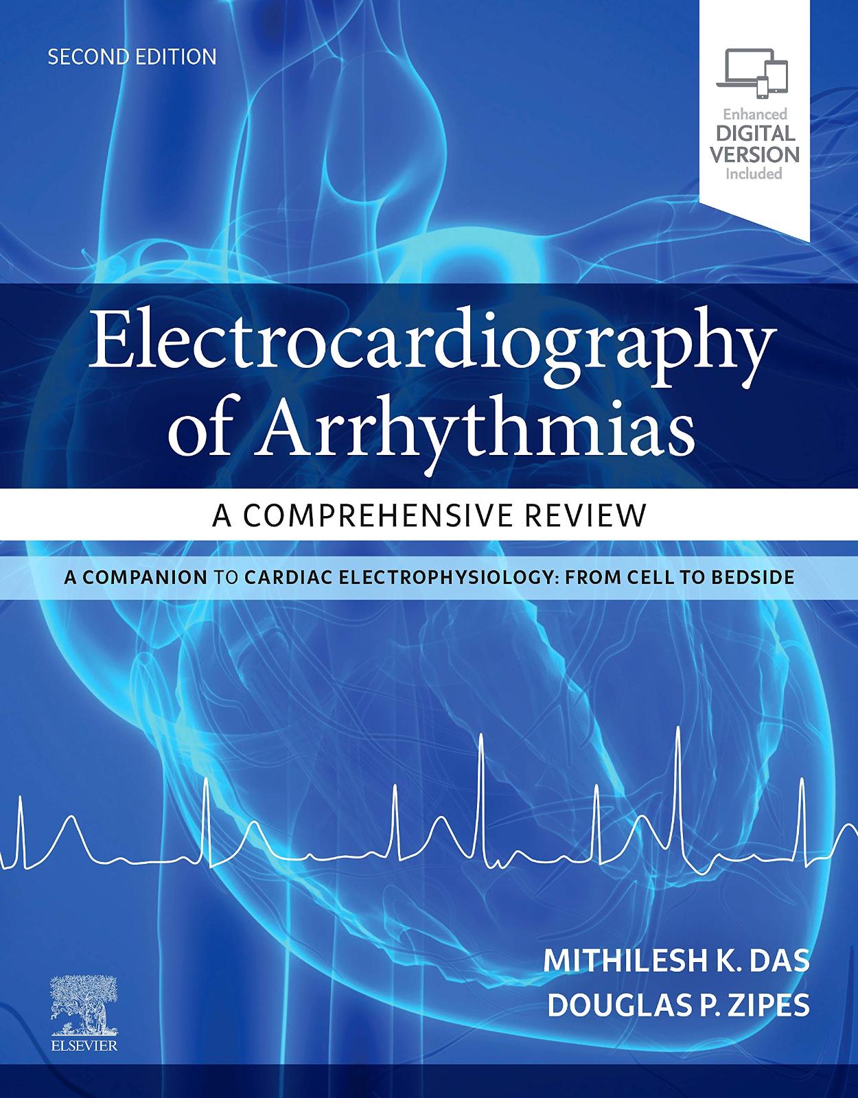 Electrocardiography of Arrhythmias: A Comprehensive Review: A Companion to Cardiac Electrophysiology