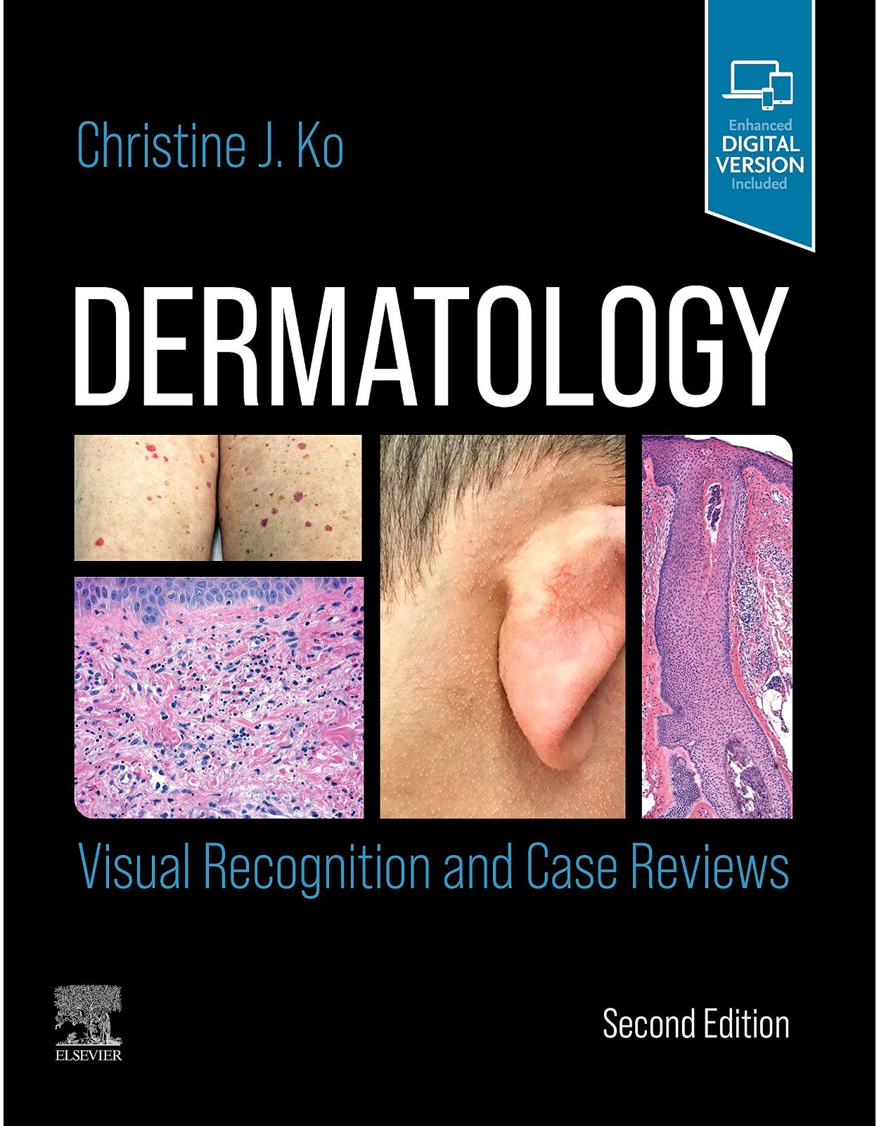 Dermatology: Visual Recognition and Case Reviews