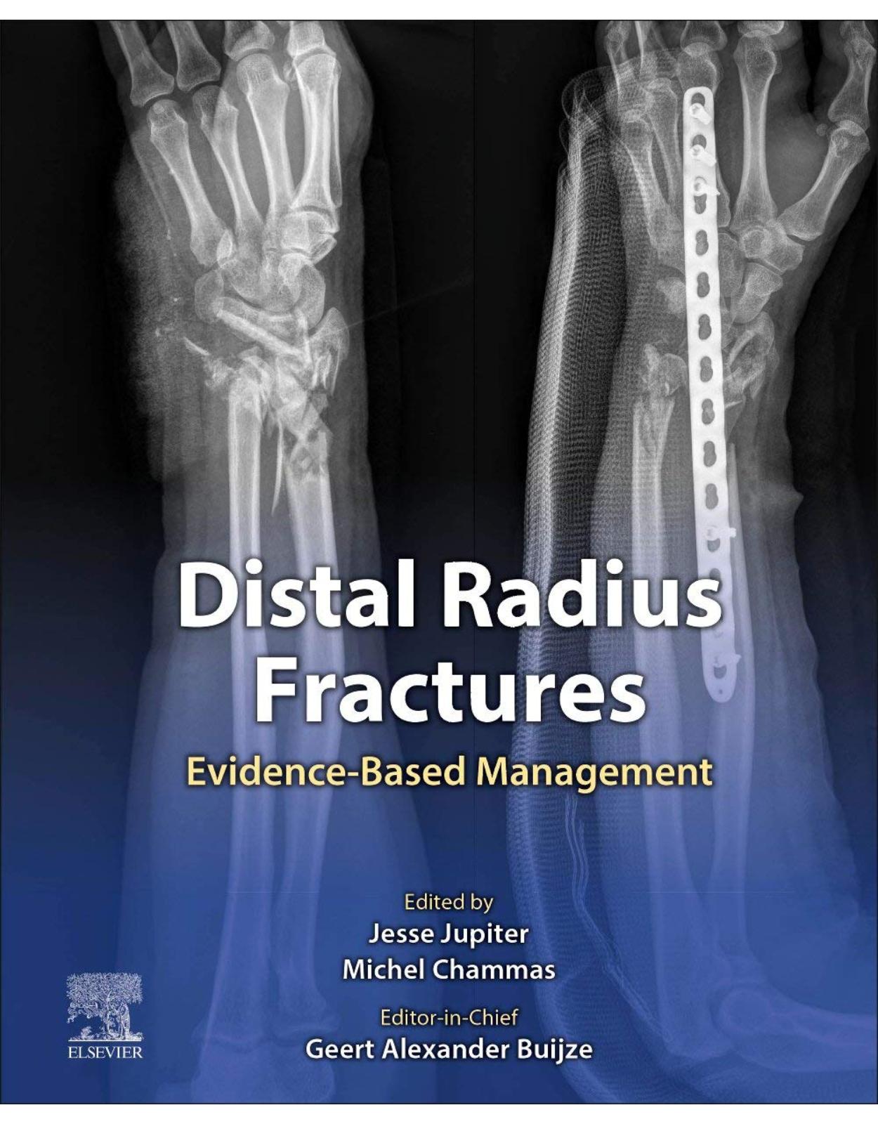 Distal Radius Fractures: Evidence-Based Management