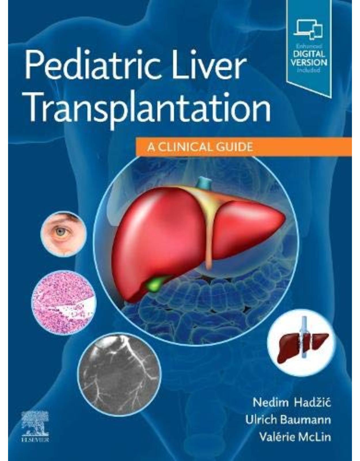 Pediatric Liver Transplantation: A Clinical Guide