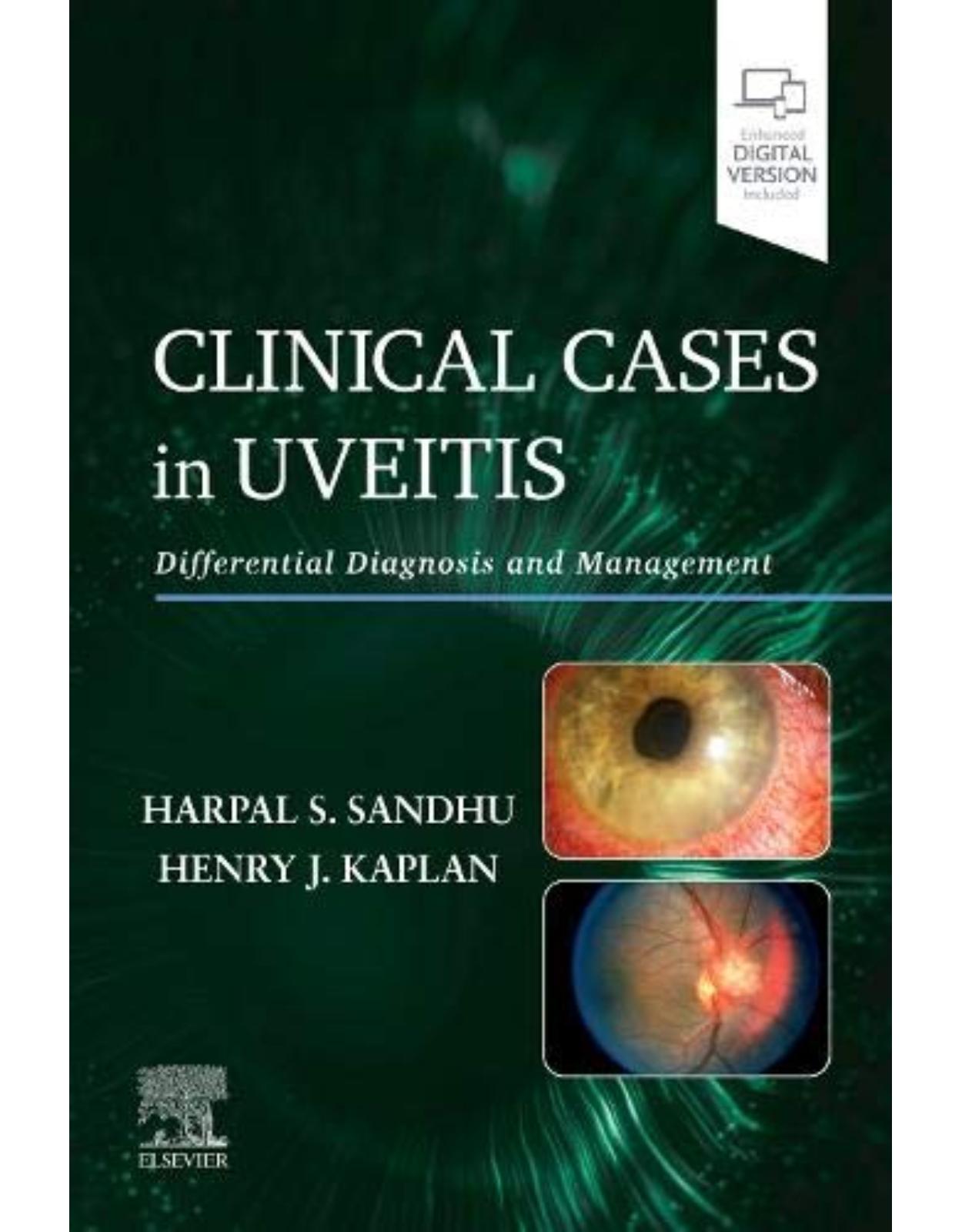 Clinical Cases in Uveitis: Differential Diagnosis and Management