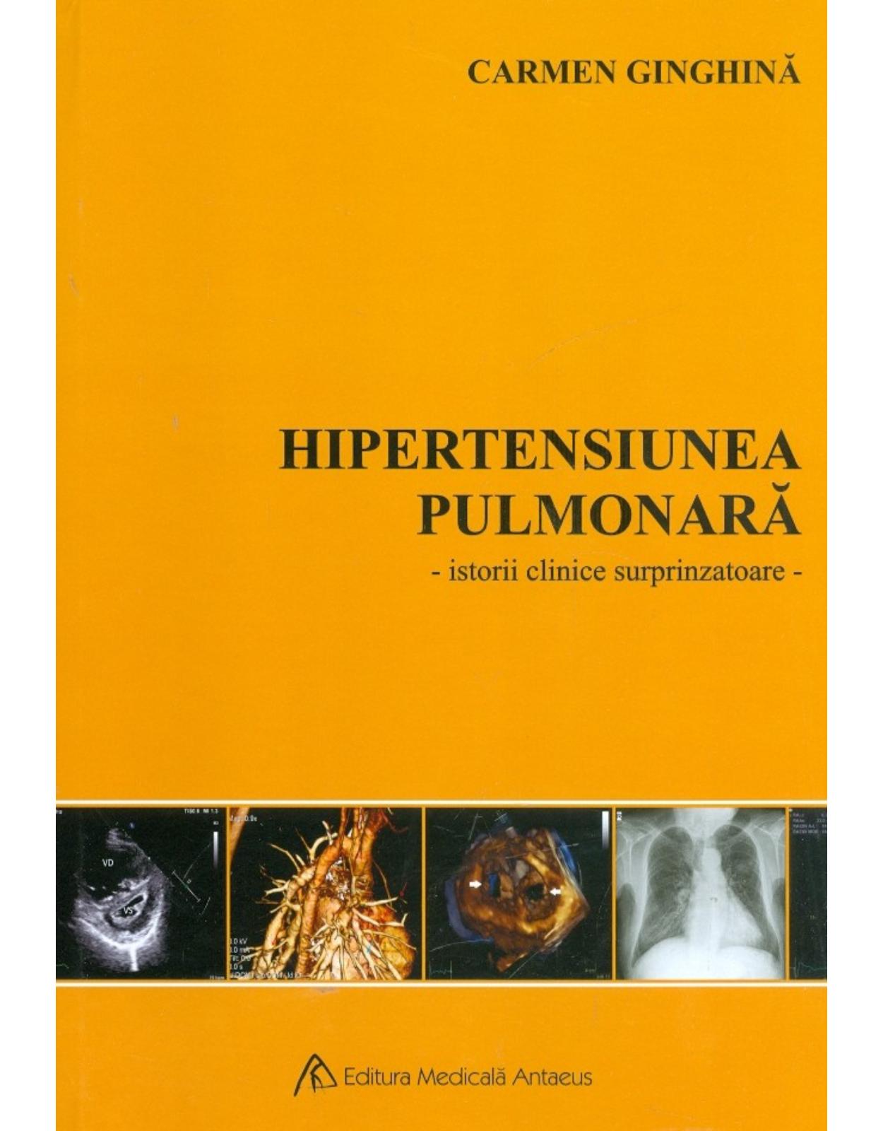 Hipertensiunea pulmonară - Istorii clinice surprinzatoare