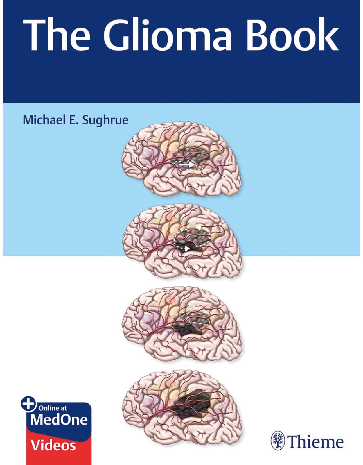 The Glioma Book 