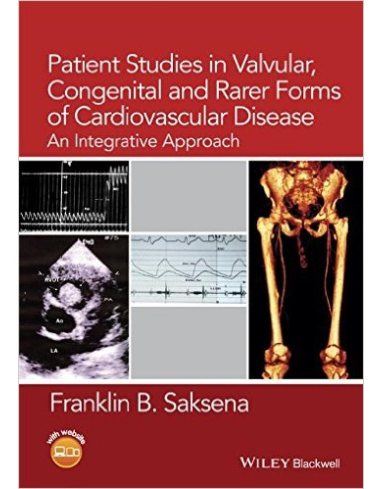 Patient Studies in Valvular, Congenital and Rarer Forms of Cardiovascular Disease: An Integrative Approach 1st Edition