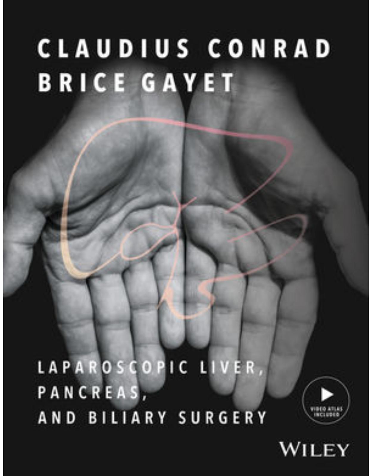  Laparoscopic Liver, Pancreas, and Biliary Surgery