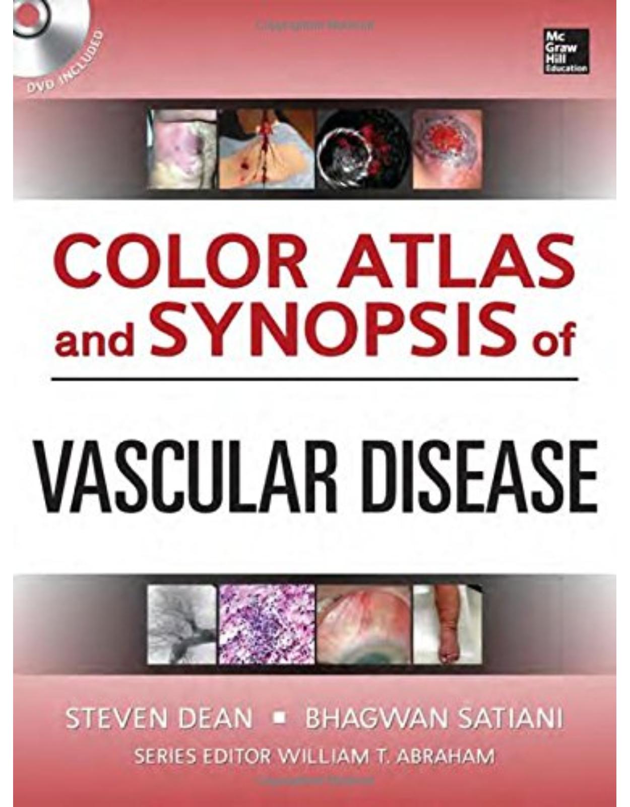 Color Atlas And Synopsis Of Vascular Medicine
