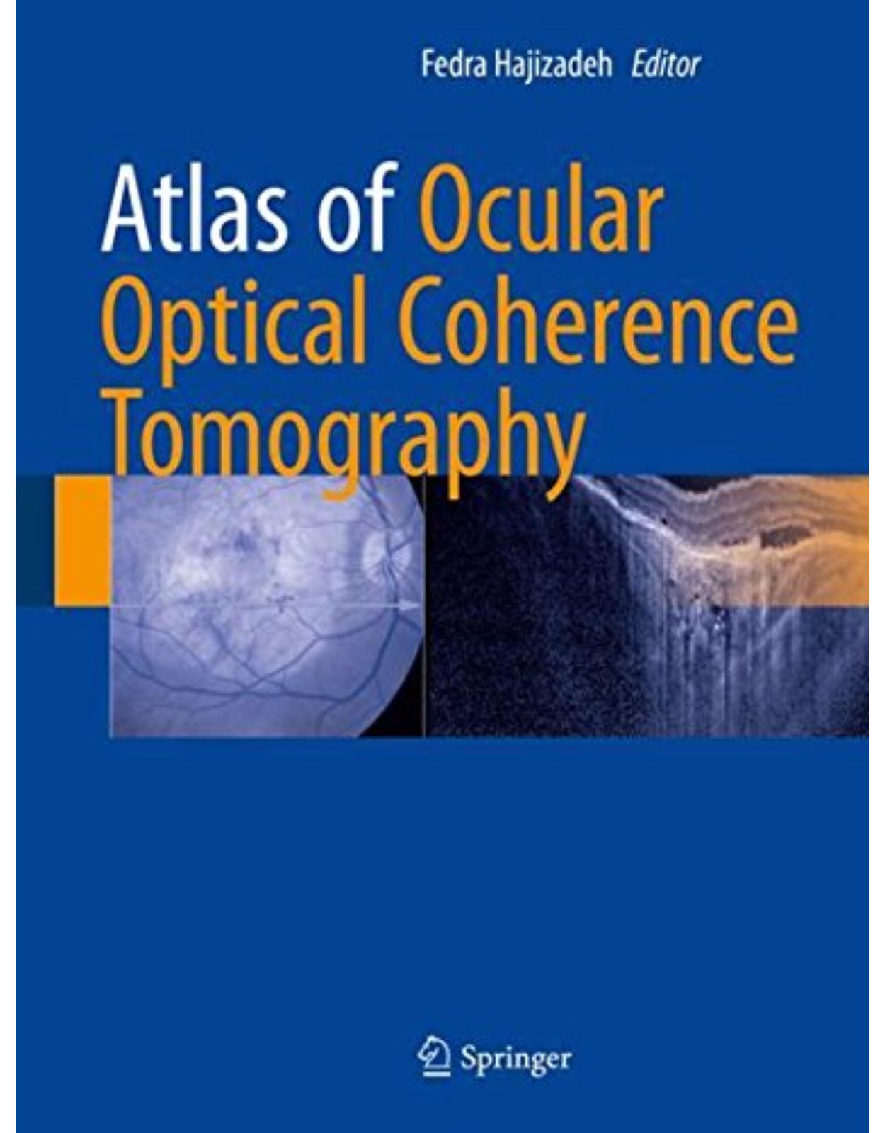 Atlas of Ocular Optical Coherence Tomography