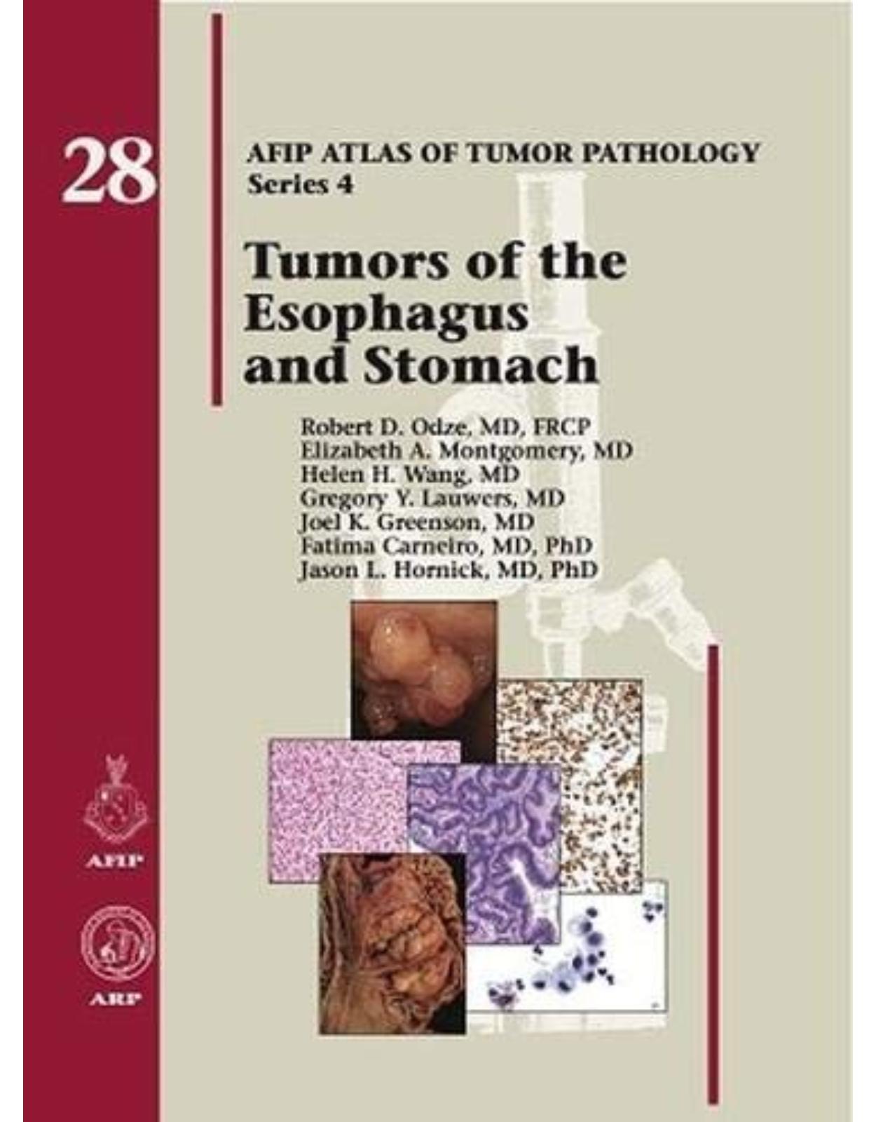 Tumors of the Esophagus and Stomach (AFIP Atlas of Tumor Pathology, Series 4,)