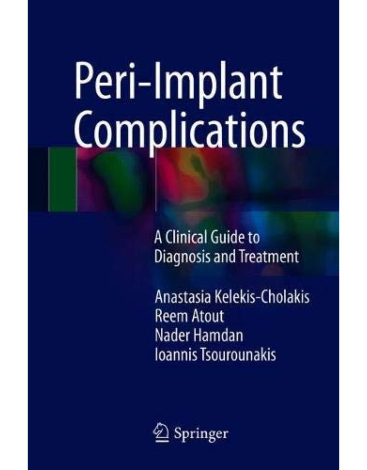 Peri-Implant Complications: A Clinical Guide to Diagnosis and Treatment