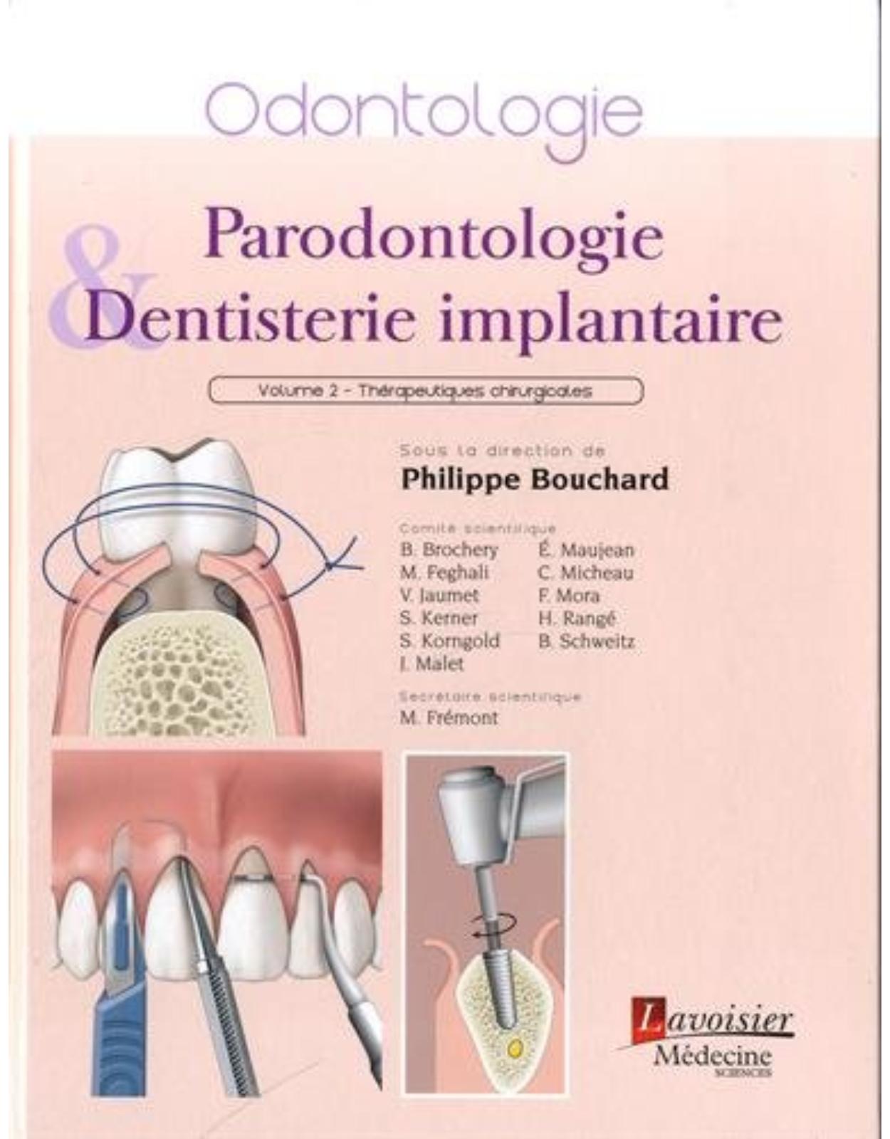Parodontologie & dentisterie implantaire : Volume 2, Therapeutiques chirurgicales