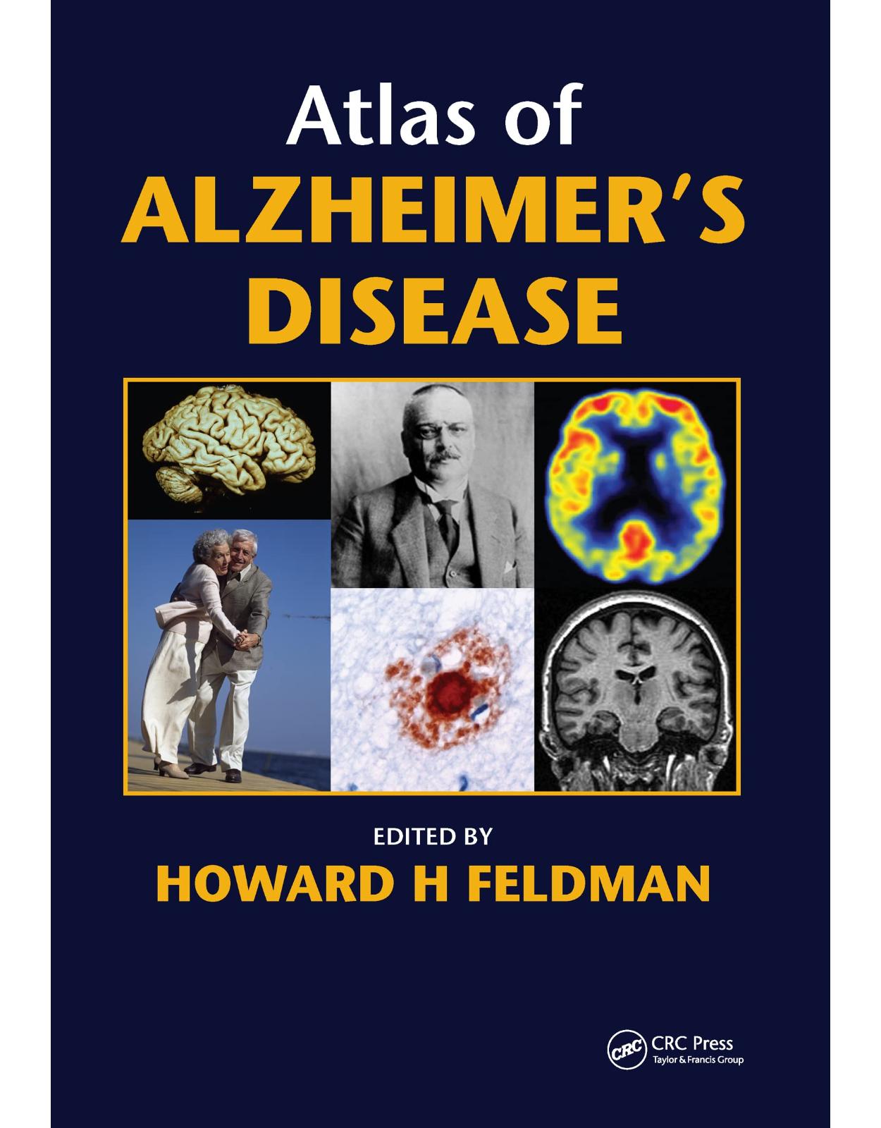 Atlas of Alzheimer’s Disease