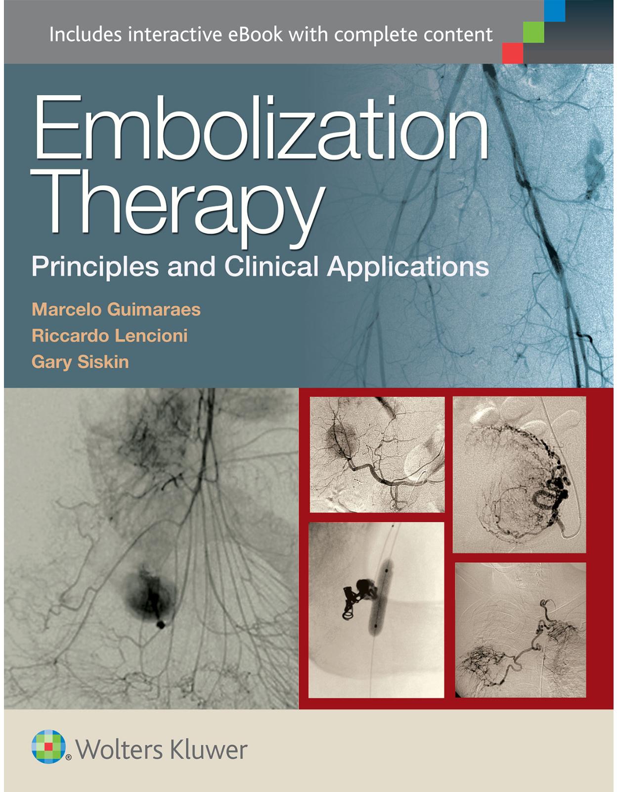 Embolization Therapy: Principles and Clinical Applications 