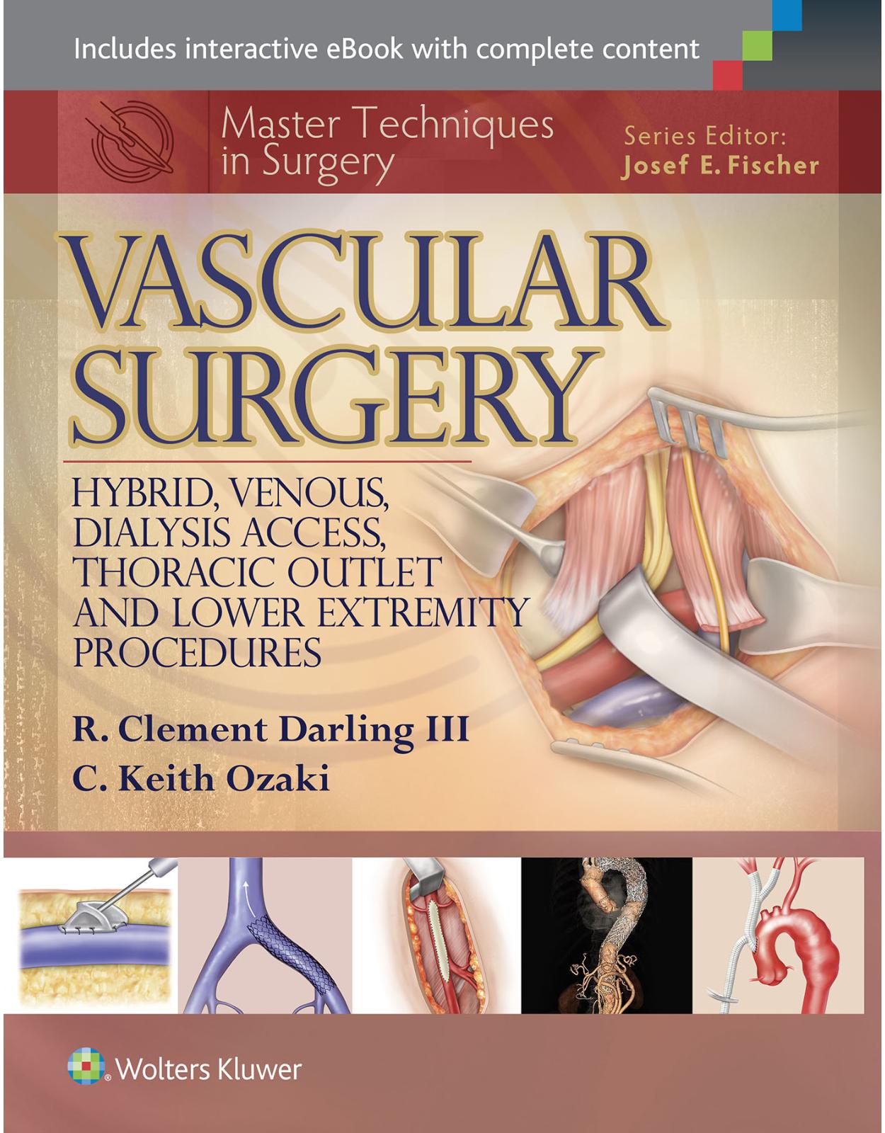 Master Techniques in Surgery: Vascular Surgery: Arterial Procedures