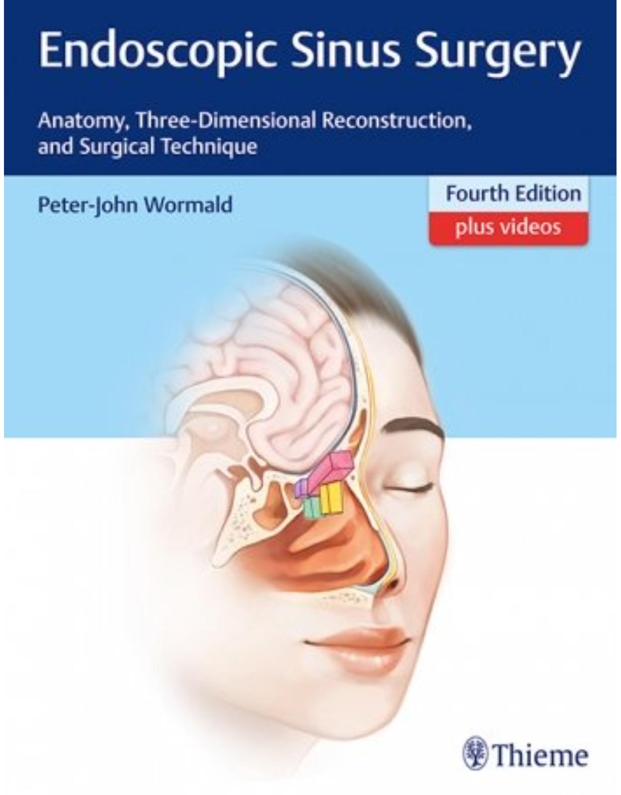 Endoscopic Sinus Surgery