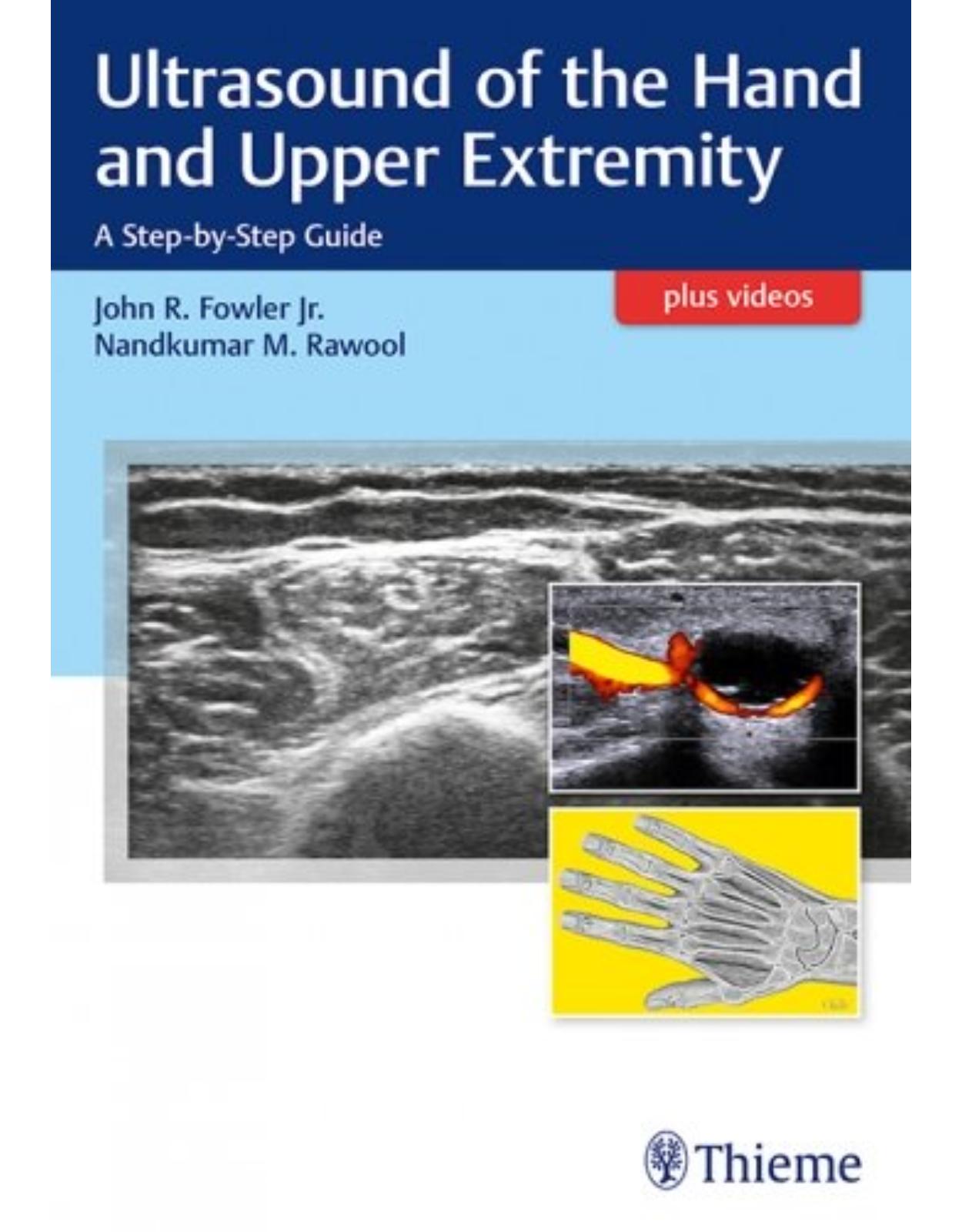 Ultrasound of the Hand and Upper Extremity