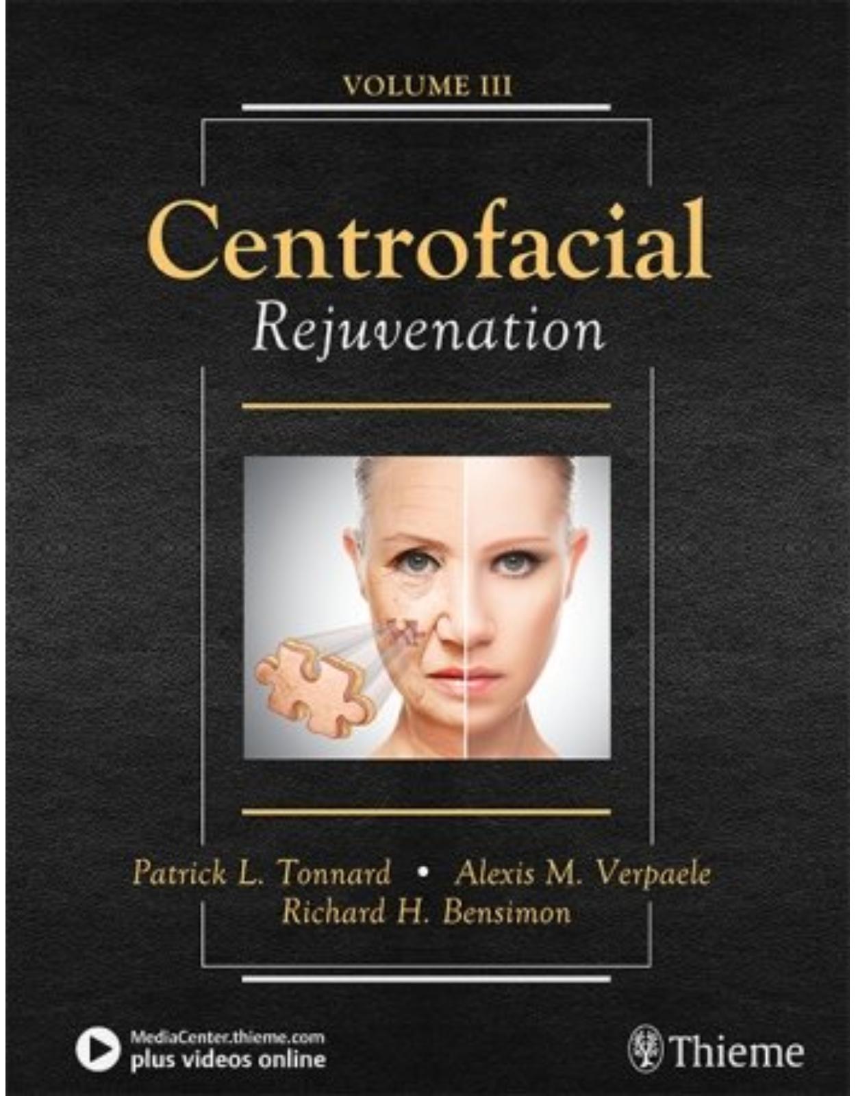 Centrofacial Rejuvenation