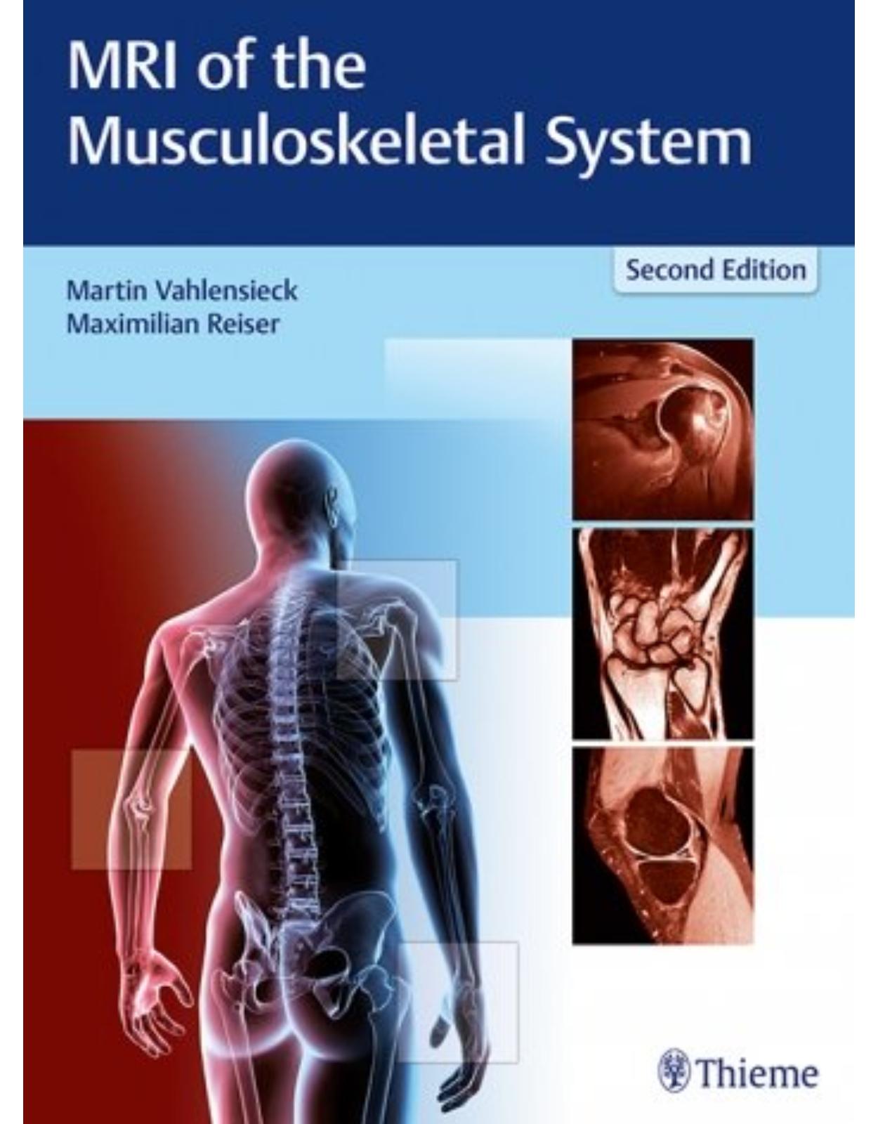  MRI of the Musculoskeletal System