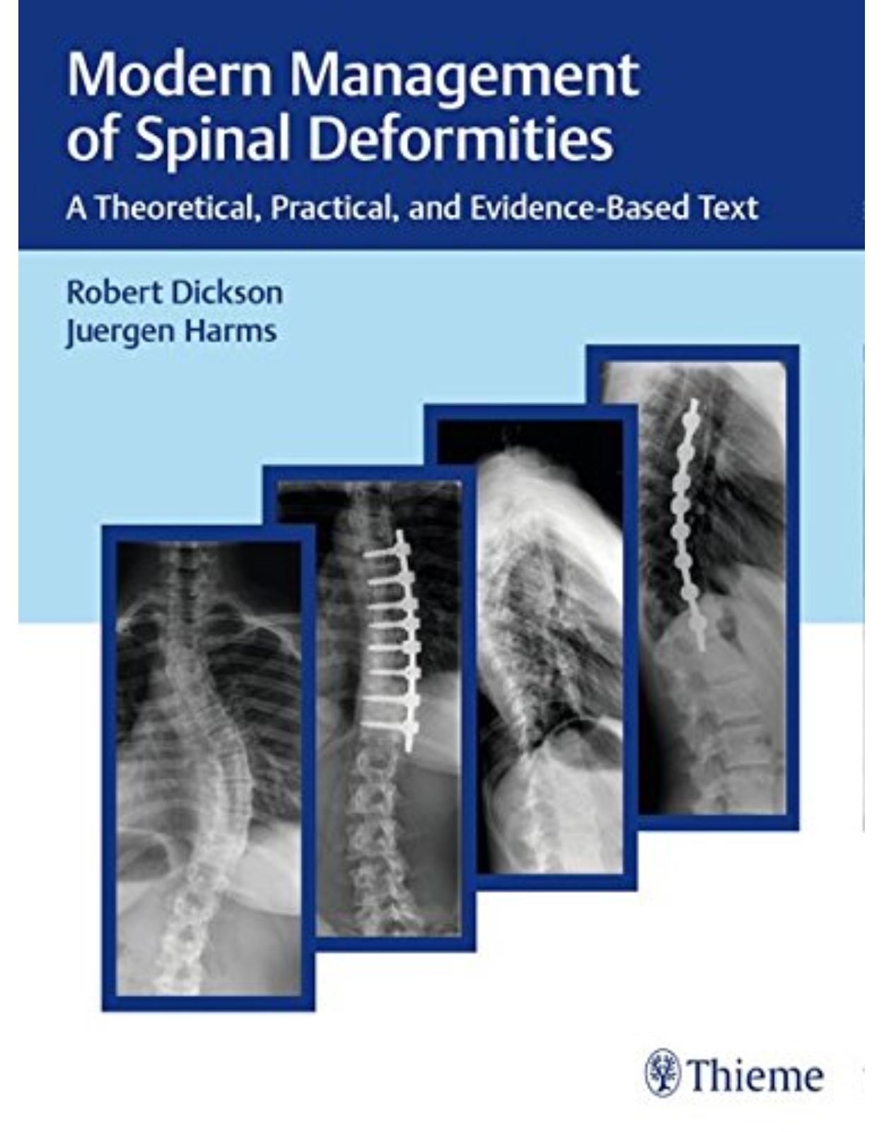 Modern Management of Spinal Deformities: A Theoretical, Practical, and Evidence-based Text