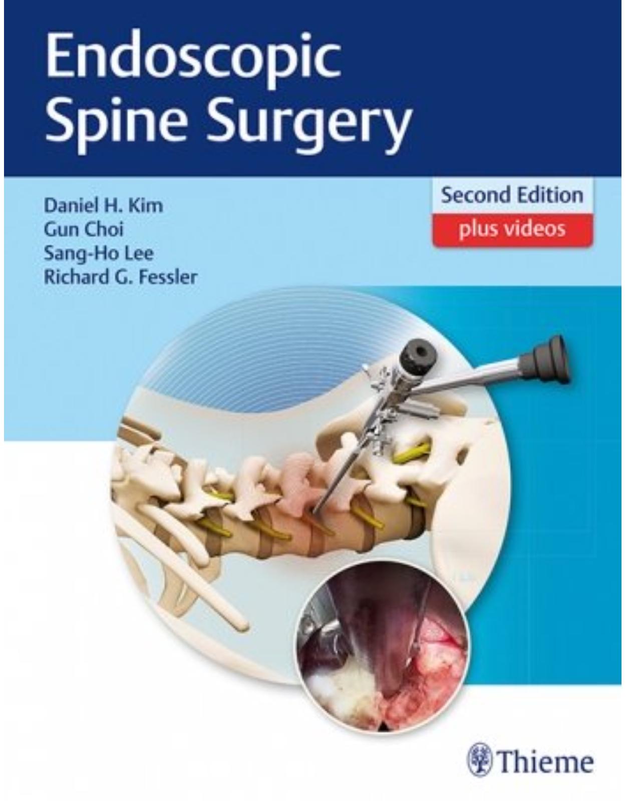 Endoscopic Spine Surgery