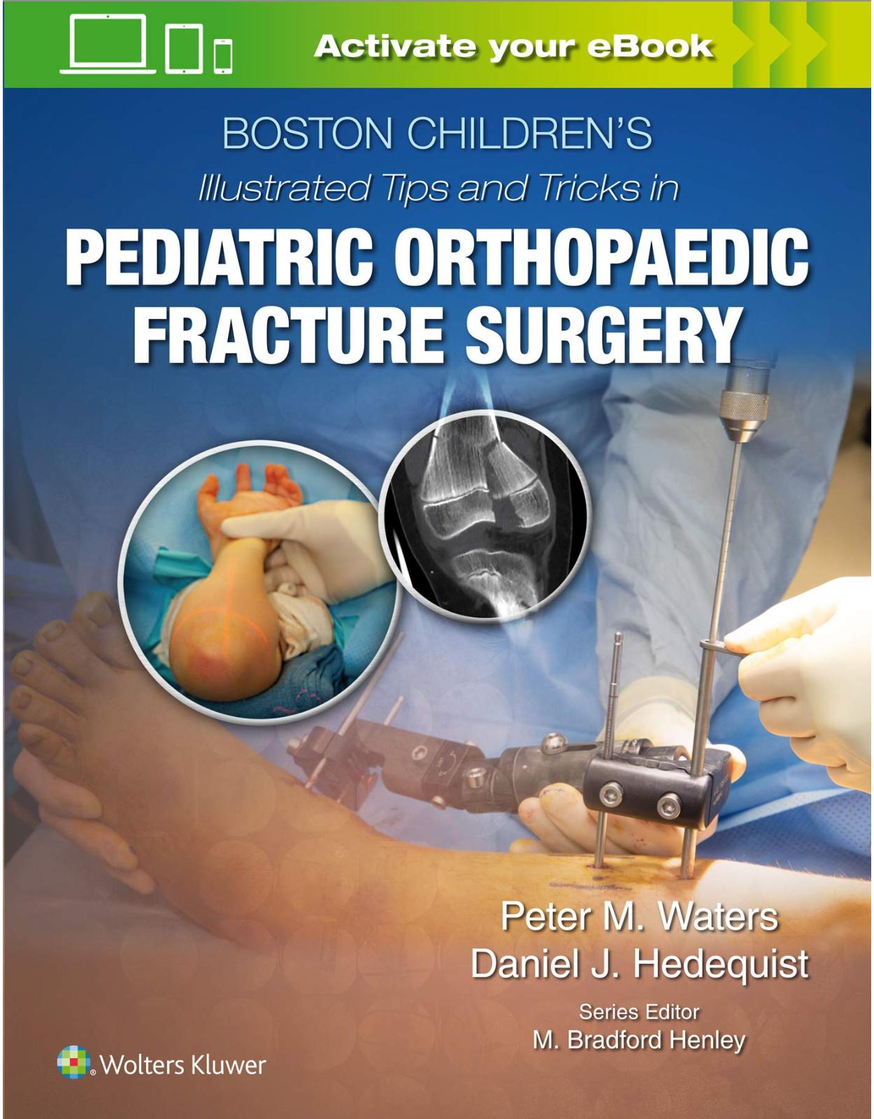 Boston Children’s Illustrated Tips and Tricks in Pediatric Orthopaedic Fracture Surgery 